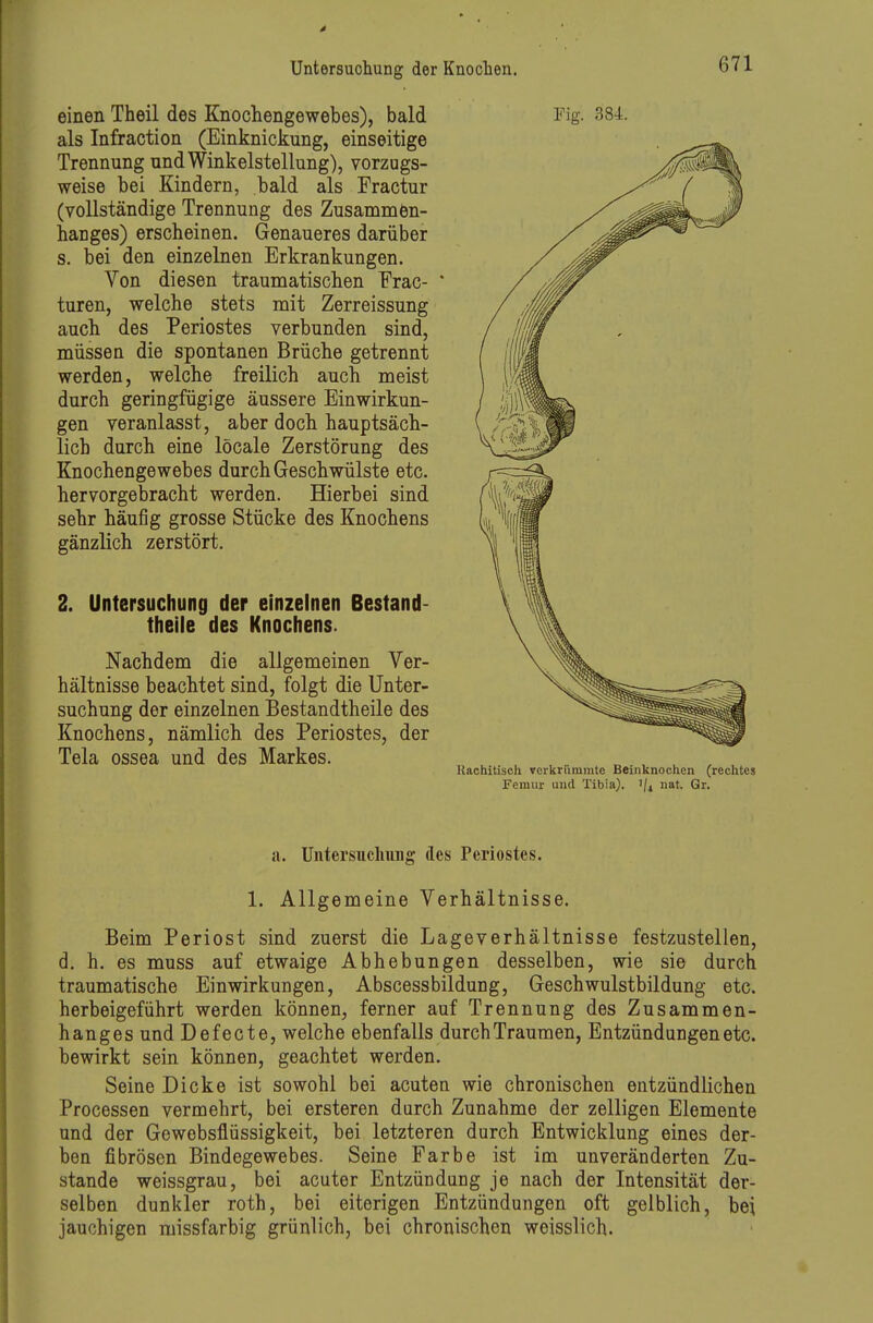 einen Theil des Knochengewebes), bald als Infraction (Einknickung, einseitige Trennung und Winkelstellung), vorzugs- weise bei Kindern, bald als Fractur (vollständige Trennung des Zusammen- hanges) erscheinen. Genaueres darüber s. bei den einzelnen Erkrankungen. Von diesen traumatischen Frac- turen, welche stets mit Zerreissung auch des Periostes verbunden sind, müssen die spontanen Brüche getrennt werden, welche freilich auch meist durch geringfügige äussere Einwirkun- gen veranlasst, aber doch hauptsäch- lich durch eine löcale Zerstörung des Knochengewebes durch Geschwülste etc. hervorgebracht werden. Hierbei sind sehr häufig grosse Stücke des Knochens gänzlich zerstört. 2. Untersuchung der einzelnen Bestand- theile des Knochens. Nachdem die allgemeinen Ver- hältnisse beachtet sind, folgt die Unter- suchung der einzelnen Bestandtheile des Knochens, nämlich des Periostes, der Tela ossea und des Markes. Fig. 384. Kachitisch verkrümmte Beinknochen (rechtes Femur und Tibia). '/^ nat. Gr. a. Untersuclniiig des Periostes. 1. Allgemeine Verhältnisse. Beim Periost sind zuerst die Lageverhältnisse festzustellen, d. h. es muss auf etwaige Abhebungen desselben, wie sie durch traumatische Einwirkungen, Abscessbildung, Geschwulstbildung etc. herbeigeführt werden können, ferner auf Trennung des Zusammen- hanges und Defecte, welche ebenfalls durch Traumen, Entzündungen etc. bewirkt sein können, geachtet werden. Seine Dicke ist sowohl bei acuten wie chronischen entzündlichen Processen vermehrt, bei ersteren durch Zunahme der zelligen Elemente und der Gewebsflüssigkeit, bei letzteren durch Entwicklung eines der- ben fibrösen Bindegewebes. Seine Farbe ist im unveränderten Zu- stande weissgrau, bei acuter Entzündung je nach der Intensität der- selben dunkler roth, bei eiterigen Entzündungen oft gelblich, bei jauchigen missfarbig grünlich, bei chronischen weisslich.