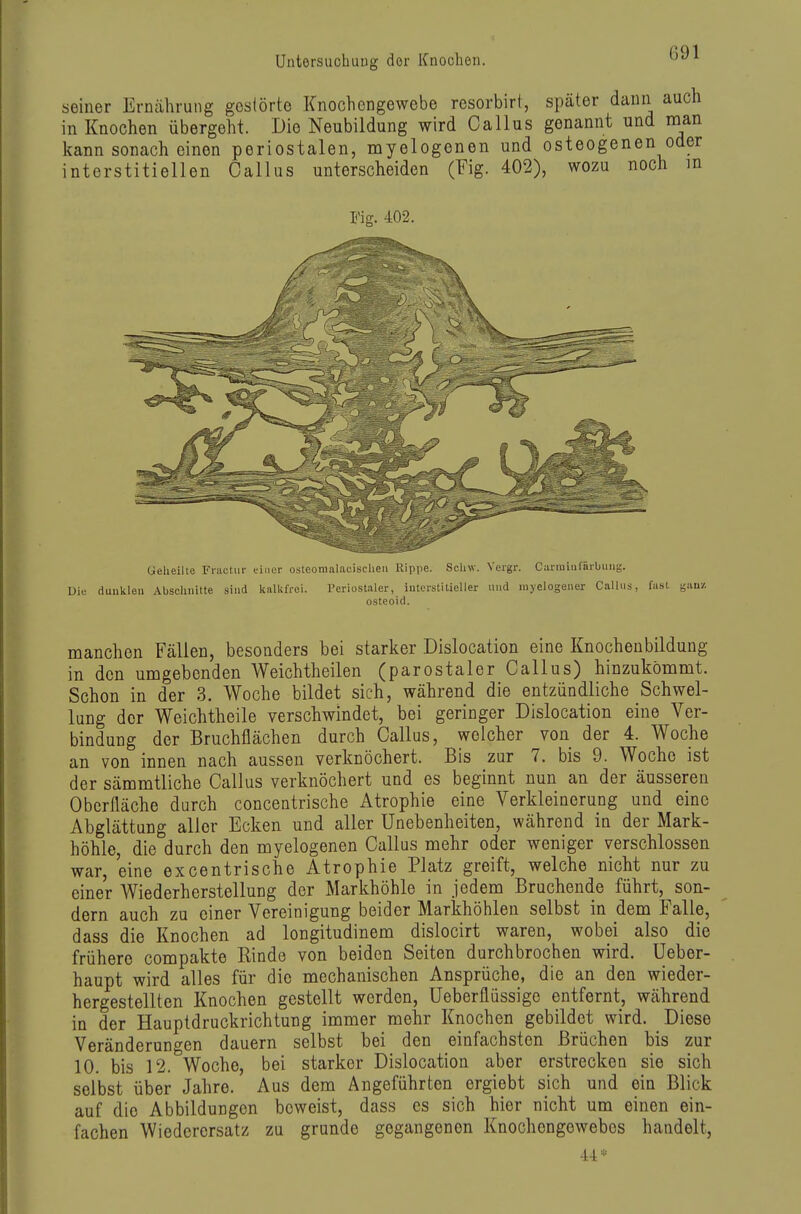 seiner Ernährung gestörte Knochengewebe resorbirt, später dann auch in Knochen übergeht. Die Neubildung wird Gallus genannt und nian kann sonach einen periostalen, myelogenen und osteogenen oder interstitiellen Gallus unterscheiden (Fig. 402), wozu noch m Fig. 402. Geheilte Fractuf einer osteoraalacisclieii Hippe. Schw. Vergr. Curmiufäibung. Die tiunkleu Abschnitte sind lialkfrei. Periostaler, interstitieller und myelogener Gallus, fast gauz osteoid. manchen Fällen, besonders bei starker Dislocation eine Knochenbildung in den umgebenden Weichtheilen (parostaler Gallus) hinzukömmt. Schon in der 3. Woche bildet sich, während die entzündliche Schwel- lung dor Weichtheile verschwindet, bei geringer Dislocation eine Ver- bindung der Bruchflächen durch Gallus, welcher von der 4. Woche an von innen nach aussen verknöchert. Bis zur 7. bis 9. Woche ist der sämmtliche Gallus verknöchert und es beginnt nun an der äusseren Oberfläche durch conceatrische Atrophie eine Verkleinerung und eine Abglättung aller Ecken und aller Unebenheiten, während in der Mark- höhle, die durch den myelogenen Gallus mehr oder weniger verschlossen war, eine excentrische Atrophie Platz greift, welche nicht nur zu einer Wiederherstellung der Markhöhle in Jedem Bruchende führt, son- dern auch zu einer Vereinigung beider Markhöhlen selbst in dem Falle, dass die Knochen ad longitudinem dislocirt waren, wobei also die frühere compakte Rinde von beiden Seiten durchbrochen wird. Ueber- haupt wird alles für die mechanischen Ansprüche, die an den wieder- hergestellten Knochen gestellt werden, Ueberflüssige entfernt, während in der Hauptdruckrichtung immer mehr Knochen gebildet wird. Diese Veränderungen dauern selbst bei den einfachsten Brüchen bis zur 10. bis 12. Woche, bei starkor Dislocation aber erstrecken sie sich selbst über Jahre. Aus dem Angeführten ergiebt sich und ein Blick auf die Abbildungen beweist, dass es sich hier nicht um einen ein- fachen Wiederersatz zu gründe gegangenen Knochengewebes handelt.