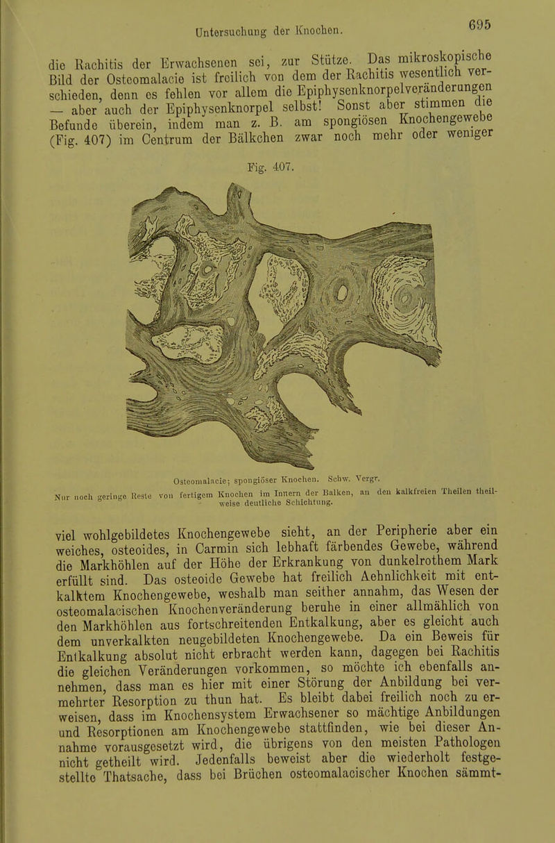 die Rachitis der Erwachsenen sei, /ar Stutze^ Das ^mikroskopische Bild der Ostcoraalacie ist freilich von deno der Rachitis wesentlich ver- schieden, denn es fehlen vor allem die Epiphysenknorpelveranderangen - aber auch der Epiphysenknorpel selbst! Sonst aber stimmen die Befunde überein, indem man z. B. am spongiösen Knochengewebe (Fig. 407) im Centrum der Bälkchen zwar noch mehr oder wemger Fig. 407. Osteonialacie; spongiöser Knochen. Schw. Vergr. Nur noch -eringe Uesle von fertigem Knochen im Innern der Balken, an den kalkfreien Theilen theil- ° weise deutliclie Schichtung. viel wohlgebildetes Knochengewebe sieht, an der Peripherie aber ein weiches, osteoides, in Carmin sich lebhaft färbendes Gewebe, während die Markhöhlen auf der Höhe der Erkrankung von dunkelrothem Mark erfüllt sind. Das osteoide Gewebe hat freilich Aehnlichkeit mit ent- kalktem Knochengewebe, weshalb man seither annahm, das Wesen der osteomalacischen Knochenveränderung beruhe in einer allmählich von den Markhöhlen aus fortschreitenden Entkalkung, aber es gleicht auch dem unverkalkten neugebildeten Knochengewebe. Da ein Beweis für Enlkalkung absolut nicht erbracht werden kann, dagegen bei Rachitis die gleichen Veränderungen vorkommen, so möchte ich ebenfalls an- nehmen, dass man es hier mit einer Störung der Anbildang bei ver- mehrter Resorption zu thun hat. Es bleibt dabei freilich noch zu er- weisen, dass im Knochensystem Erwachsener so mächtige Anbildungen und Resorptionen am Knochengewebe stattfinden, wie bei dieser An- nahme vorausgesetzt wird, die übrigens von den meisten Pathologen nicht getheilt wird. Jedenfalls beweist aber die wiederholt festge- stellte Thatsache, dass bei Brüchen ostoomalacischer Knochen sämmt-