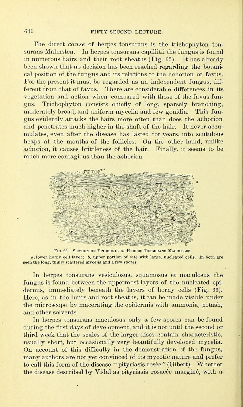 The direct cause of herpes tonsurans is the trichophyton ton- surans Malmsten. In herpes tonsurans capilHtii the fungus is found in numerous hairs and their root sheaths (Fig. 65). It has already- been shown that no decision has been reached regarding the botani- cal position of the fungus and its relations to the achorion of favus. For the present it must be regarded as an independent fungus, dif- ferent from that of favus. There are considerable differences in its vegetation and action when compared with those of the favus fun- gus. Trichophyton consists chiefly of long, sparsely branching, moderately broad, and uniform mycelia and few gonidia. This fun- gus evidently attacks the hairs more often than does the achorion and penetrates much higher in the shaft of the hair. It never accu- mulates, even after the disease has lasted for years, into scutulous heaps at the mouths of the follicles. On the other hand, unlike achorion, it causes brittleness of the hair. Finally, it seems to be much more contagious than the achorion. Fig. 66.—Section of Epidermis in Herpes Tonsurans Maculosus. a, lower horny cell layer; b, upper portion of rete with large, nucleated cells. In both are seen the long, thinly scattered mycelia and a few spores. In herpes tonsurans vesiculosus, squamosus et maculosus the fungus is found between the uppermost layers of the nucleated epi- dermis, immediately beneath the layers of horny cells (Fig. 66). Here, as in the hairs and root sheaths, it can be made visible under the microscope by macerating the epidermis with ammonia, potash, and other solvents. In herpes tonsurans maculosus only a few spores can be found during the first days of development, and it is not until the second or third week that the scales of the larger discs contain characteristic, usually short, but occasionally very beautifully developed mycelia. On account of this difficulty in the demonstration of the fungus, many authors are not yet convinced of its mycotic nature and prefer to call this form of the disease  pityriasis rosee  (Gibert). Whether the disease described by Vidal as pityriasis rosacee margine, with a
