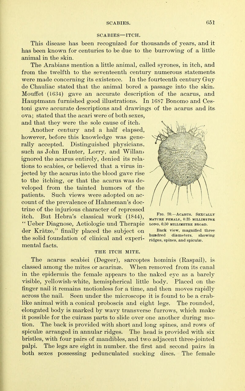 SCABIES—ITCH. This disease has been recognized for thousands of years, and it has been known for centuries to be due to the burrowing of a httle animal in the skin. The Arabians mention a httle animal, called syrones, in itch, and from the twelfth to the seventeenth century numerous statements were made concerning its existence. In the fourteenth century Guy de Chauliac stated that the animal bored a passage into the skin. Mouffet (1634) gave an accurate description of the acarus, and Hauptmann furnished good illustrations. In 1687 Bonomo and Ces- toni gave accurate descriptions and drawings of the acarus and its- ova; stated that the acari were of both sexes, and that they were the sole cause of itch. Another century and a half elapsed, however, before this knowledge was gene- rally accepted. Distinguished physicians, such as John Hunter, Lorry, and Willan^ ignored the acarus entirely, denied its rela- tions to scabies, or believed that a virus in- jected by the acarus into the blood gave rise to the itching, or that the acarus was de- veloped from the tainted humors of the patients. Such views were adopted on ac- count of the prevalence of Hahneman's doc- trine of the injurious character of repressed itch. But Hebra's classical work (1844), '' Ueber Diagnose, Aetiologie und Therapie der Kratze, finally placed the subject on the solid foundation of clinical and experi- mental facts. THE ITCH MITE. The acarus scabiei (Degeer), sarcoptes hominis (Raspail), is classed among the mites or acarinae. When removed from its canal in the epidermis the female appears to the naked eye as a barely visible, yellowish-white, hemispherical little body. Placed on the- finger nail it remains motionless for a time, and then moves rapidly across the nail. Seen under the microscope it is found to be a crab- like animal with a conical proboscis and eight legs. The rounded, elongated body is marked by wavy transverse furrows, which make it possible for the cuirass parts to slide over one another during mo- tion. The back is provided with short and long spines, and rows of spiculse arranged in annular ridges. The head is provided with six bristles, with four pairs of mandibles, and two adjacent three-jointed palpi. The legs are eight in number, the first and second pairs in both sexes possessing pedunculated sucking discs. The female Fig. 70.—Acarus. Sexually mature female, 0.35 millimetre long, 0.50 millimetre broad. Back view, magnified three huBdred diameters, showing ridges, spines, and spiculae.
