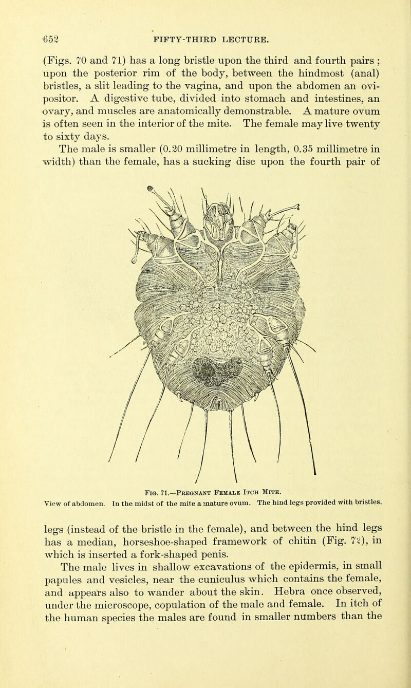 (Figs. 70 and 71) has a long bristle upon the third and fourth pairs ; upon the posterior rim of the body, between the hindmost (anal) bristles, a slit leading to the vagina, and upon the abdomen an ovi- positor. A digestive tube, divided into stomach and intestines, an ■ovary, and muscles are anatomically demonstrable. A mature ovum is often seen in the interior of the mite. The female may live twenty to sixty days. The male is smaller (0.20 millimetre in length, 0.35 millimetre in width) than the female, has a sucking disc upon the fourth pair of Fig. 71.—Pregnant Female Itch Mite. View of abdomen. In the midst of the mite a mature ovum. The hind legs provided with bristles. legs (instead of the bristle in the female), and between the hind legs has a median, horseshoe-shaped framework of chitin (Fig. 7<!), in which is inserted a fork-shaped penis. The male lives in shallow excavations of the epidermis, in small papules and vesicles, near the cuniculus which contains the female, and appears also to wander about the skin. Hebra once observed, under the microscope, copulation of the male and female. In itch of the human species the males are found in smaller numbers than the