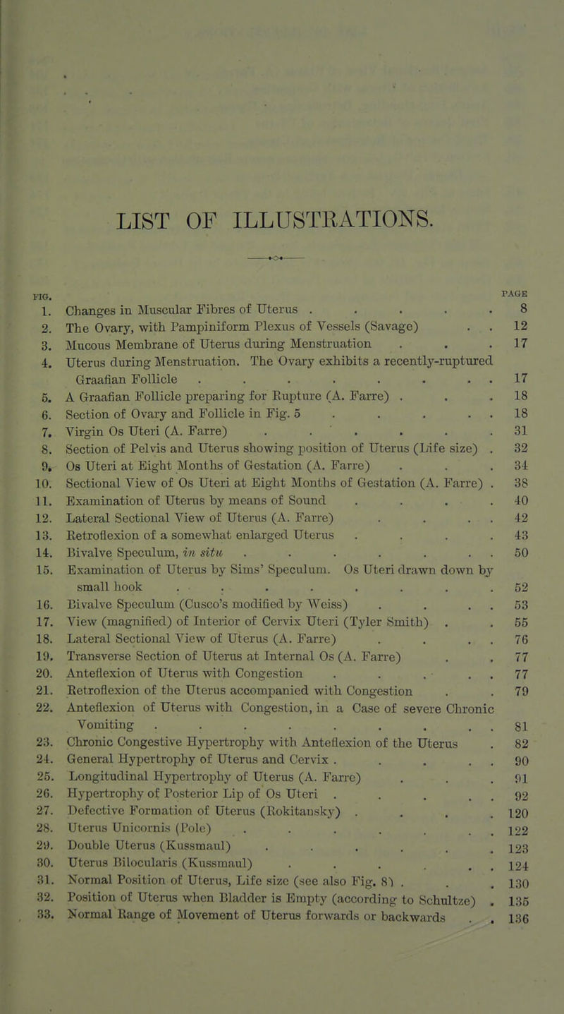 LIST OF ILLUSTRATIONS. FIG. 1. Changes in Muscular Fibres of Uterus . 2. The Ovary, with Pampiniform Plexus of Vessels (Savage) 3. Mucous Membrane of Uterus during Menstruation 4. Uterus during Menstruation. The Ovary exhibits a recently-ruptured Graafian Follicle ...... 5. A Graafian Follicle preparing for Eupture (A. FaiTe) . 6. Section of Ovary and Follicle in Fig. 5 . . . 7. Virgin Os Uteri (A. Farre) . . . 8. Section of Pelvis and Uterus showing position of Uterus (Life size) 9. Os Uteri at Eight Months of Gestation (A. Farre) 10. Sectional View of Os Uteri at Eight Months of Gestation (A. Farre) 11. Examination of Uterus by means of Sound 12. Lateral Sectional View of Uterus (A. Farre) 13. Retroflexion of a somewhat enlarged Uterus 14. Bivalve Speculum, in situ ..... 15. Examination of Uterus by Sims' Speculum. Os Uteri drawn down by small hook . . 16. Bivalve Speculum (Cusco's modified by Weiss) 17. View (magnified) of Interior of Cervix Uteri (Tyler Smith) 18. Lateral Sectional View of Uterus (A. Farre) 19. Transverse Section of Uterus at Internal Os (A. Farre) 20. Anteflexion of Uterus with Congestion 21. Retroflexion of the Uterus accompanied with Congestion 22. Anteflexion of Uterus with Congestion, in a Case of severe Chronic Vomiting ....... 23. Chronic Congestive Hypertrophy with Anteflexion of the Uterus 24. General Hypertrophy of Uterus and Cervix . 25. Longitudinal Hypertrophy of Uterus (A. Farre) 26. Hypertrophy of Posterior Lip of Os Uteri . 27. Defective Formation of Uterus (Rokitansky) 28. Uterus Unicornis (I'dh;) ..... 21). Double Uterus (Kussmaul) • ■ . . . 30. Uterus Bilocularis (Kussmaul) .... 31. Normal Pcsition of Uterus, Life size (see also Fig. 8) . 32. Position of Uterus when Bladder is Empty (according to Schultze) 33. Normal Range of Movement of Uterus forwards or backwards PAGE 8 12 17