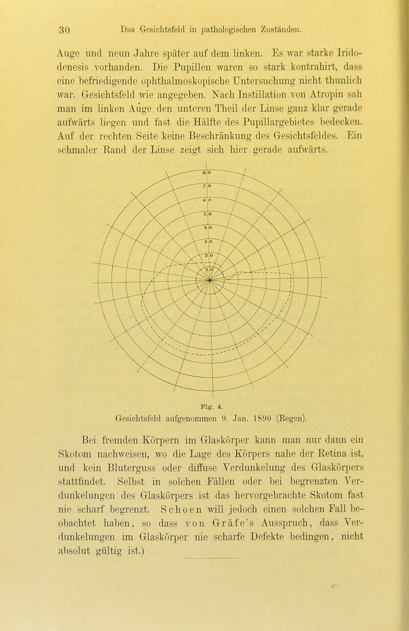 Auge und neun Jahre später auf dem linken. Es war starke Irido- denesis vorhanden. Die Pupillen waren so stark kontrahirt, dass eine beMedigende ophthalmoskopische Untersuchung nicht thunlich war. Gesichtsfeld wie angegeben. Nach Instillation von Atropin sah man im linken Aiige den unteren Theil der Linse ganz klar gerade aufwärts liegen und fast die Hälfte des Pupillargebietes bedecken. Auf der rechten Seite keine Beschränkung des Gesichtsfeldes. Ein schmaler Eand der Linse zeigt sich hier gerade aufwärts. Fig. 4. Gesichtsfeld aufgenommen 9. Jan. 1890 (Regen). Bei fi-emden Körpern im Glaskörper kann man nur dann ein Skotom nachweisen, wo die Lage des Körpers nahe der Eetina ist, und kein Bluterguss oder difPuse Verdunkelung des Glasköipers stattfindet. Selbst in solchen Fällen oder bei begrenzten Ver- dunkelungen des Glaskörpers ist das hervorgebrachte Skotom fast nie scharf begrenzt. Schoen will jedoch einen solchen Fall be- obachtet haben, so dass von Gräfe's Ausspruch, dass Ver- dunkelungen im Glaskörper nie scharfe Defekte bedingen, nicht absolut gültig ist.)