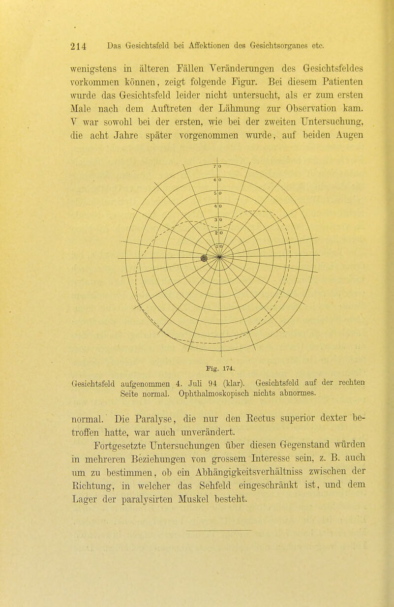wenigstens in älteren Fällen Veränderungen des Gesichtsfeldes vorkommen können, zeigt folgende Figur. Bei diesem Patienten wurde das Gesichtsfeld leider nicht untersucht, als er zum ersten Male nach dem Auftreten der Lähmung zur Observation kam. V war sowohl bei der ersten, wie bei der zweiten Untersuchung, die acht Jahre später vorgenommen wurde, auf beiden Augen Kg. 174. Gesichtsfeld aufgenommen 4. JuM 94 (klar). Gesichtsfeld auf der rechten Seite normal. Ophthalmoskopisch nichts abnormes. normal. Die Paralyse, die nur den Rectus superior dexter be- troffen hatte, war auch unverändert. Fortgesetzte Untersuchungen über diesen Gegenstand wüi-deu in mehi-eren Beziehungen von grossem Interesse sein, z. B. auch um zu bestimmen, ob ein Abhängigkeitsverhältniss zwischen der Richtung, in welcher das Sehfeld eingeschränkt ist, und dem Lager der paralysü'ten Muskel besteht.