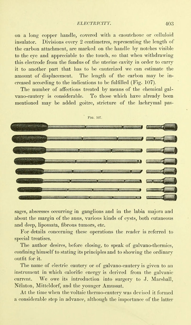 on a long copper handle, covered with a caoutchouc or celluloid insulator. Divisions every 2 centimetres, representing the length of the carbon attachment, are marked on the handle by notches visible to the eye and appreciable to the touch, so that when withdrawing this, electrode from the fundus of the uterine cavity in order to carry it to another part that has to be cauterized we can estimate the amount of displacement. The length of the carbon may be in- creased according to the indications to be fulfilled (Fig. 107). The number of affections treated by means of the chemical gal- vano-cautery is considerable. To those which have already been mentioned may be added goitre, stricture of the lachrymal pas- FlG. 107. sages, abscesses occurring in ganglions and in the labia majora and about the margin of the anus, various kinds of cysts, both cutaneous and deep, liponiata, fibrous tumors, etc. For details concerning these operations the reader is referred to special treatises. The author desires, before closing, to speak of galvano-thermics, confining himself to stating its principles and to showing the ordinary outfit for it. The name of electric cautery or of galvano-cautery is given to an instrument in which calorific energy is derived from the galvanic current. We owe its introduction into surgery to J. Marshall, Nelaton, Mitteldorf, and the younger Amussat. At the time when the voltaic thermo-cautery was devised it formed a considerable step in advance, although the importance of the latter