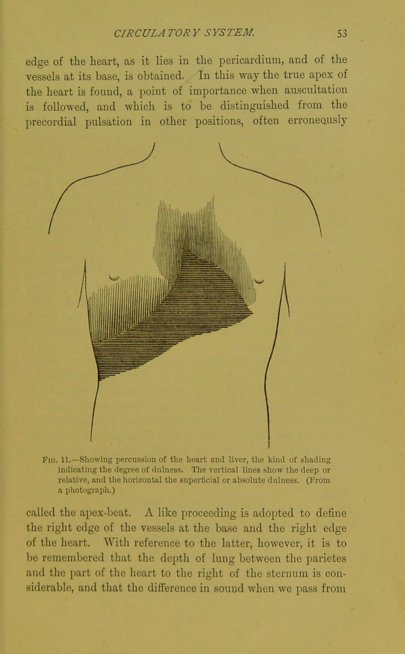 edge of the heart, as it lies in the pericardium, and of the vessels at its base, is obtained. In this way the true apex of the heart is found, a point of importance when auscultation is followed, and which is to be distinguished from the precordial pulsation in other positions, often erroneously Fio. 11.—Showing percussion of the lieart and liver, the kind of shading indicating tlie degree of dulness. The vertical lines show the deep or relative, and the horizontal the superficial or absolute dulness. (From a photograph.) called the apex-beat. A like proceeding is adopted to define the right edge of the vessels at the base and the right edge of the heart. With reference to the latter, however, it is to be remembered that the depth of lung between the parietes and the part of the heart to the right of the sternum is con- siderable, and that the difference in sound when we pass from