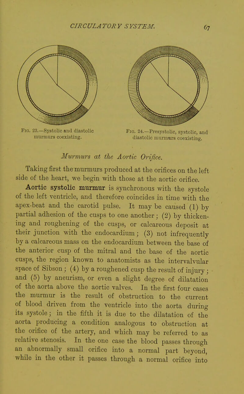 Fia. 23.—Systolic and diastolic Fig. 24.—Presystolic, systolic, and murmurs coexisting. diastolic niurmnrs coexisting. Murmurs at the Aortic Orifice. Taking first the murmurs produced at the orifices on the left side of the heart, we begin with those at the aortic orifice. Aortic systolic murmur is synchronous with the systole of the left ventricle, and therefore coincides in time with the apex-beat and the carotid pulse. It may be caused (1) by partial adhesion of the cusps to one another; (2) by thicken- ing and roughening of the cusps, or calcareous deposit at their junction with the endocardium; (3) not infrequently by a calcareous mass on the endocardium between the base of the anterior cusp of the mitral and the base of the aortic cusps, the region known to anatomists as the intervalvular space of Sibson; (4) by a roughened cusp the result of injury; and (5) by aneurism, or even a slight degree of dilatation of the aorta above the aortic valves. In the first four cases the murmur is the result of obstruction to the current of blood driven from the ventricle into the aorta during its systole; in the fifth it is due to the dilatation of the aorta producing a condition analogous to obstruction at the orifice of the artery, and which may be referred to as relative stenosis. In the one case the blood passes through an abnormally small orifice into a normal part beyond, while in the other it passes through a normal orifice into