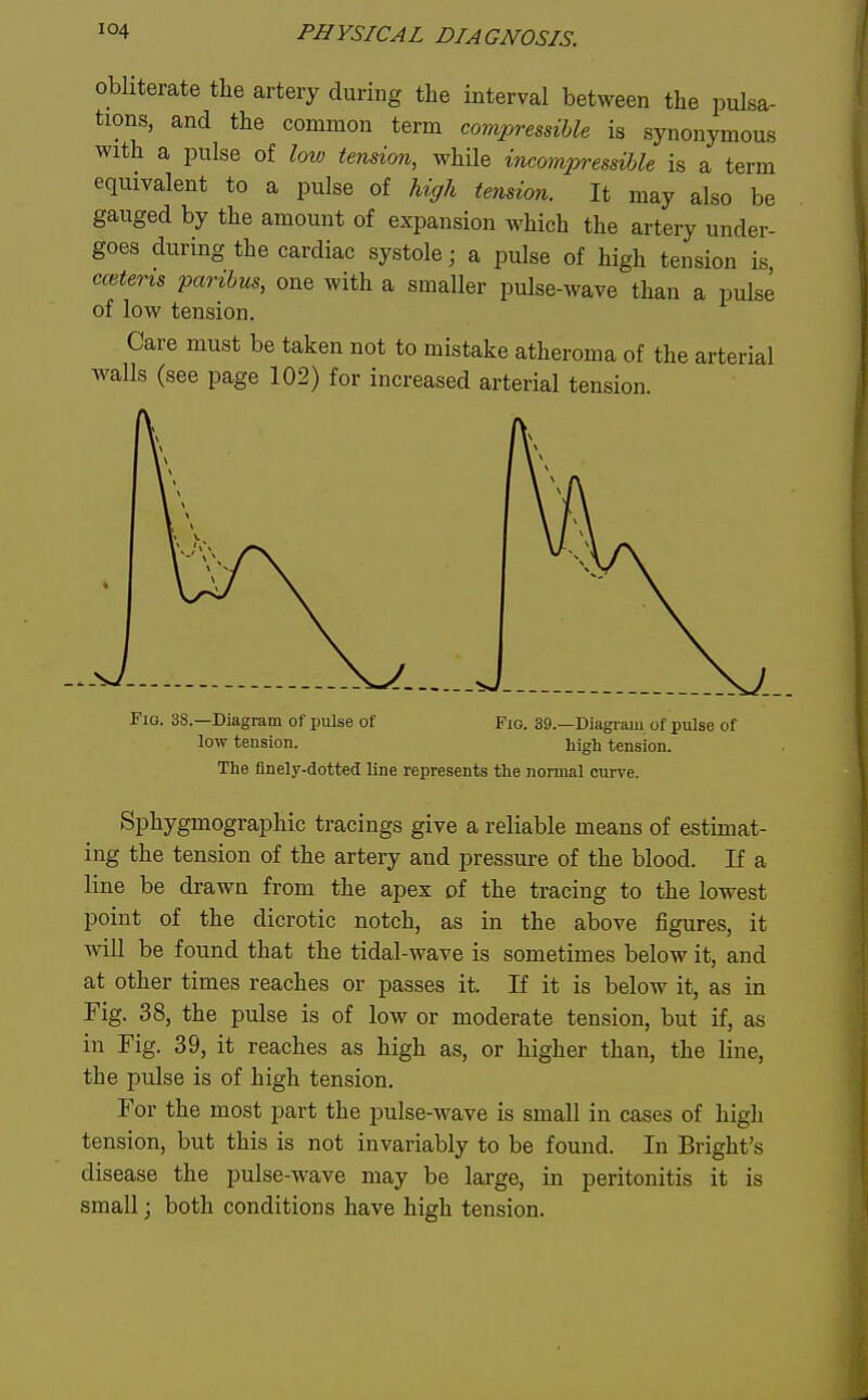 obliterate the artery during tlie interval between the pulsa- tions, and the common term compressible is synonymous with a iDulse of low tension, while incompressible is a term equivalent to a pulse of high tension. It may also be gauged by the amount of expansion which the artery under- goes during the cardiac systole; a pulse of high tension is ccetens paribus, one with a smaller pulse-wave than a pulse of low tension. Care must be taken not to mistake atheroma of the arterial walls (see page 102) for increased arterial tension. Fio. 38.—Diagram of pulse of low tension. Fig. 39.—Diagram of pulse of high tension. The finely-dotted line represents the normal curiae. Sphygmographic tracings give a reliable means of estimat- ing the tension of the artery and pressure of the blood. If a line be drawn from the apex of the tracing to the lowest point of the dicrotic notch, as in the above figures, it will be found that the tidal-wave is sometimes below it, and at other times reaches or passes it. If it is below it, as in Fig. 38, the pulse is of low or moderate tension, but if, as in Fig. 39, it reaches as high as, or higher than, the line, the pulse is of high tension. For the most part the pulse-wave is small in cases of high tension, but this is not invariably to be found. In Bright's disease the pulse-wave may be large, in peritonitis it is small; both conditions have high tension.