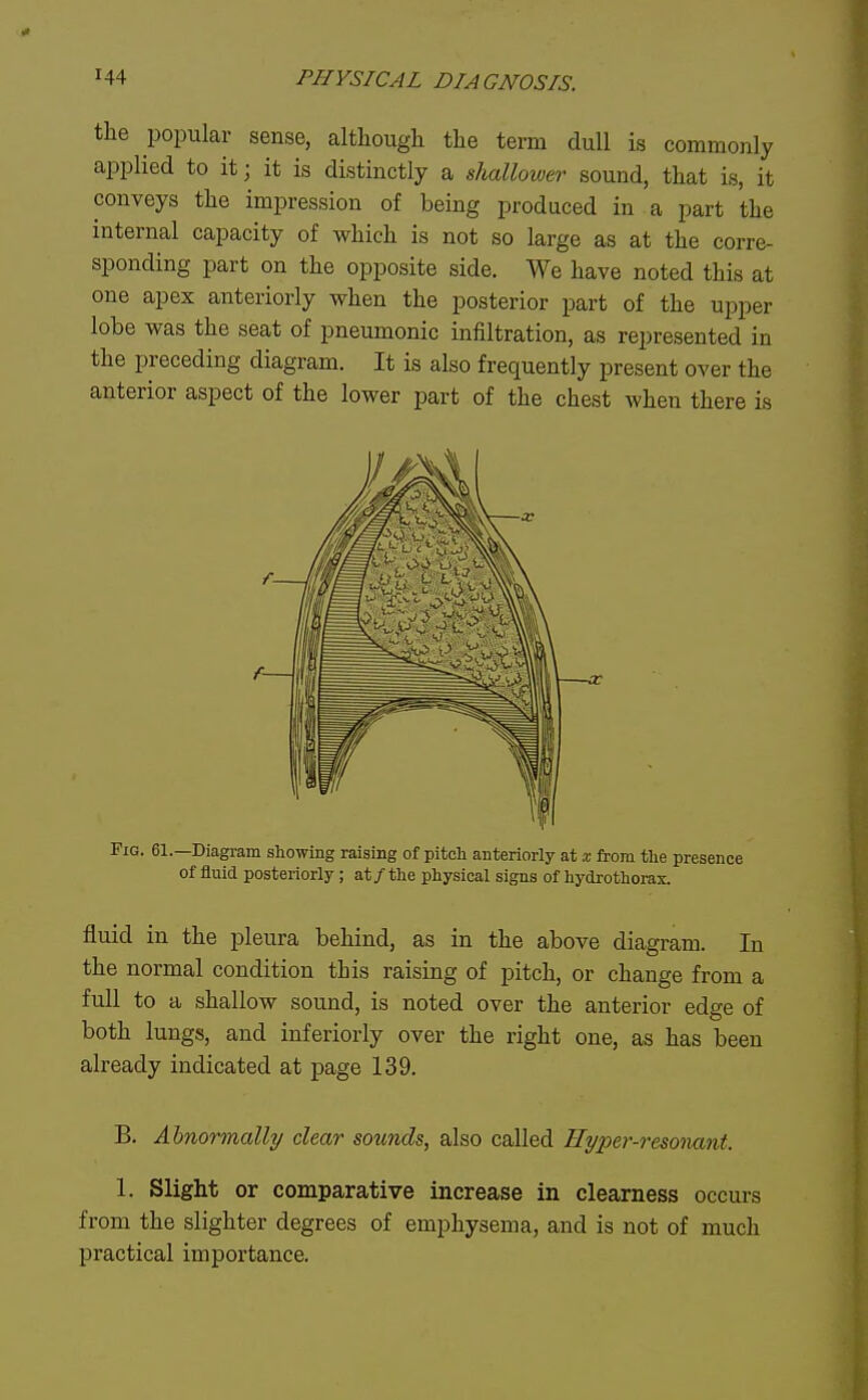 the popular sense, although the term dull is commonly applied to it; it is distinctly a shallower sound, that is, it conveys the impression of being produced in a part the internal capacity of which is not so large as at the corre- sponding part on the opposite side. We have noted this at one apex anteriorly when the posterior part of the upper lobe was the seat of pneumonic infiltration, as represented in the preceding diagram. It is also frequently present over the anterior aspect of the lower part of the chest when there is Fig. 61.—Diagram sliowing raising of pitch anteriorly at x from the presence of fluid posteriorly ; at/the physical signs of hydrothorax. fluid in the pleura behind, as in the above diagram. In the normal condition this raising of pitch, or change from a full to a shallow sound, is noted over the anterior edge of both lungs, and inferiorly over the right one, as has been already indicated at page 139. B. Abnormally clear sounds, also called Hyper-resonant. 1. Slight or comparative increase in clearness occurs from the slighter degrees of emphysema, and is not of much practical importance.