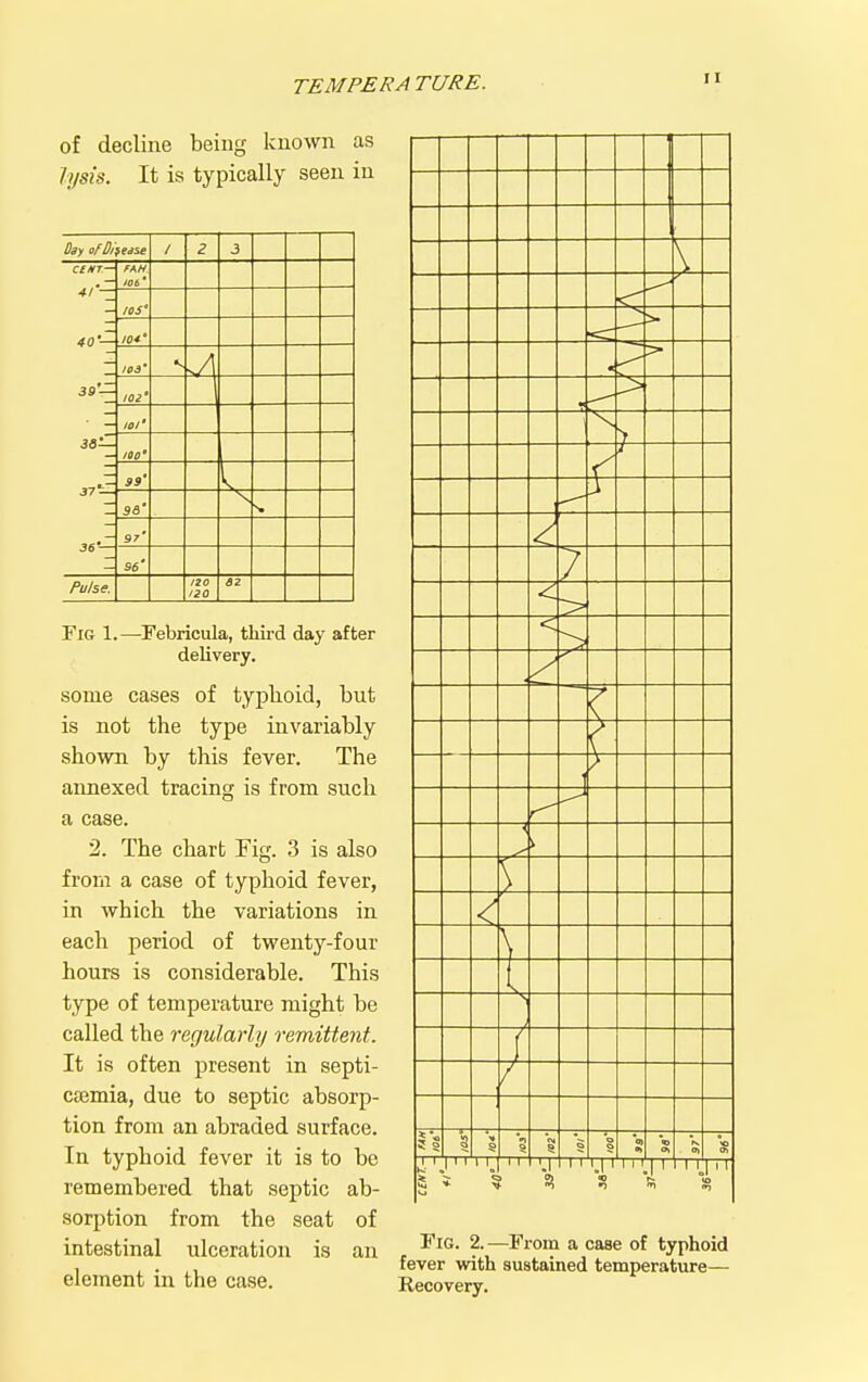 of decline being known as lysis. It is typically seen in day ofS/fedse 1 2 3 C£/tT~ fAH lOb * _ 40 — 39 — /OS* 10*' 103' •- lOi' lOl' 3S— JOo' 39' 37 — 96' 97' 36 — 96' Pulse. 120 120 Fig 1.—rebricula, third day after delivery. some cases of typhoid, but is not the type invariably shown by this fever. The annexed tracing is from such a case. 2. The chart Fig. 3 is also frorn a case of typhoid fever, in which the variations in each period of twenty-four hours is considerable. This type of temperature might be called the regularly remittent. It is often present in septi- cemia, due to septic absorp- tion from an abraded surface. In typhoid fever it is to be remembered that septic ab- sorption from the seat of intestinal ulceration is an element in the case. I ' \ ■ 7 > < > C > < < s s o 9\ Fig. 2.—From a case of typhoid fever with sustained temperature— Recovery.