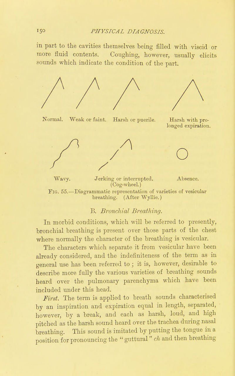 in part to the cavities themselves heing filled with viscid or more fluid contents. Coughing, however, usually elicits sounds which indicate the condition of the part. Normal. Weak or faint. Harsh or puerile. Harsh with pro- longed expiration. Wavy. Jerking or interrupted. Absence. (Cog-wheel.) Tig. 55.—Diagrammatic representation of varieties of vesicular breathing. (After WyHie.) B. Bronchial Breathing. In morbid conditions, which will be referred to presently, bronchial breathing is present over those parts of the chest where normally the character of the breathing is vesicular. The characters which separate it from vesicular have been already considered, and the indefiniteness of the term as in general use has been referred to ; it is, however, desirable to describe more fully the various varieties of breathing sounds heard over the pulmonary parenchyma which have been included under this head. First. The term is applied to breath sounds characterised by an inspiration and expiration equal in length, separated, however, by a break, and each as harsh, loud, and high pitched as the harsb sound heard over the trachea during nasal breathing. This sound is imitated by putting the tongue in a position for pronouncing the  guttural ch and then breathing