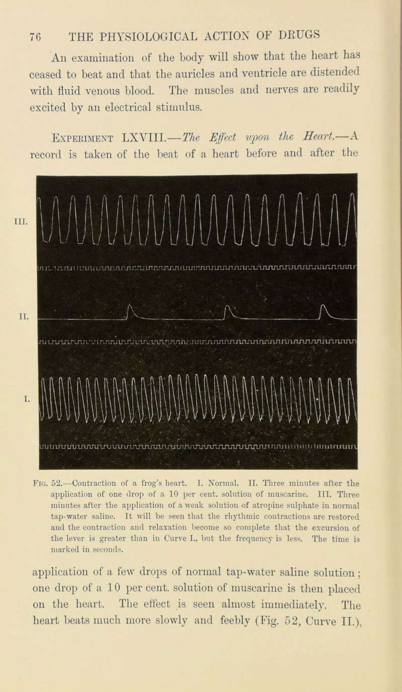 An examination of the body will show that the heart has ceased to beat and that the auricles and ventricle are distended with fluid venous blood. The muscles and nerves are readily excited by an electrical stimulus. Experiment LXYIII.—The Effect upon the Heart.—A record is taken of the beat of a heart before and after the Fig. 52.—Contraction of a frog’s heart. I. Normal. II. Three minutes after the application of one drop of a 10 per cent, solution of muscarine. III. Three minutes after the application of a weak solution of atropine sulphate in normal tap-water saline. It will be seen that the rhythmic contractions are restored and the contraction and relaxation become so complete that the excursion of the lever is greater than in Curve I., but the frequency is less. The time is marked in seconds. application of a few drops of normal tap-water saline solution ; one drop of a 10 per cent, solution of muscarine is then placed on the heart. The effect is seen almost immediately. The heart beats much more slowly and feebly (Fig. 52, Curve II.),