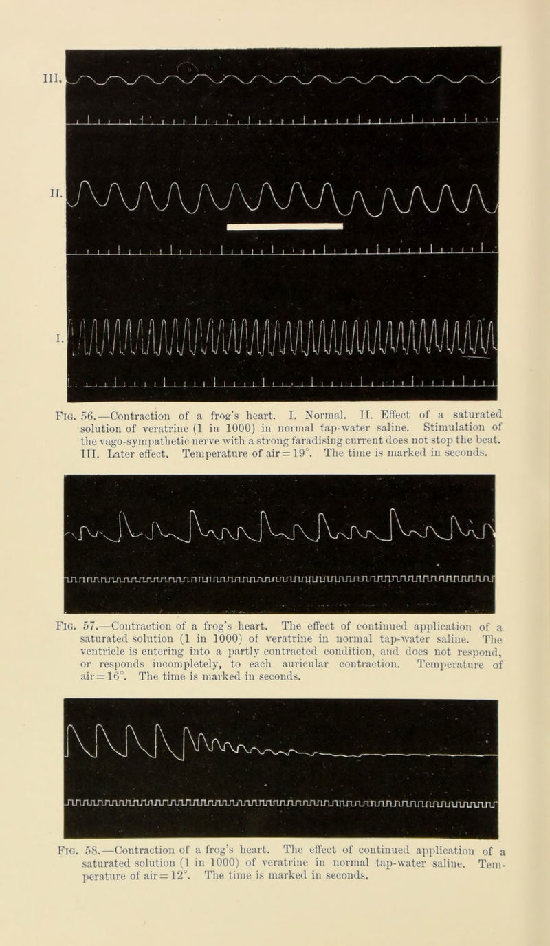 Fig. 56.—Contraction of a frog’s heart. I. Normal. II. Effect of a saturated solution of veratrine (1 in 1000) in normal tap-water saline. Stimulation of the vago-sympathetic nerve with a strong faradising current does not stop the beat. TII. Later effect. Temperature of air = 19°. The time is marked in seconds. Fig. 57.—Contraction of a frog’s heart. The effect of continued application of a saturated solution (1 in 1000) of veratrine in normal tap-water saline. The ventricle is entering into a partly contracted condition, and does not respond, or responds incompletely, to each auricular contraction. Temperature of air —16°. The time is marked in seconds. Fig. 58.—Contraction of a frog’s heart. The effect of continued application of a saturated solution (1 in 1000) of veratrine in normal tap-water saline. Tem- perature of air=12°. The time is marked in seconds.