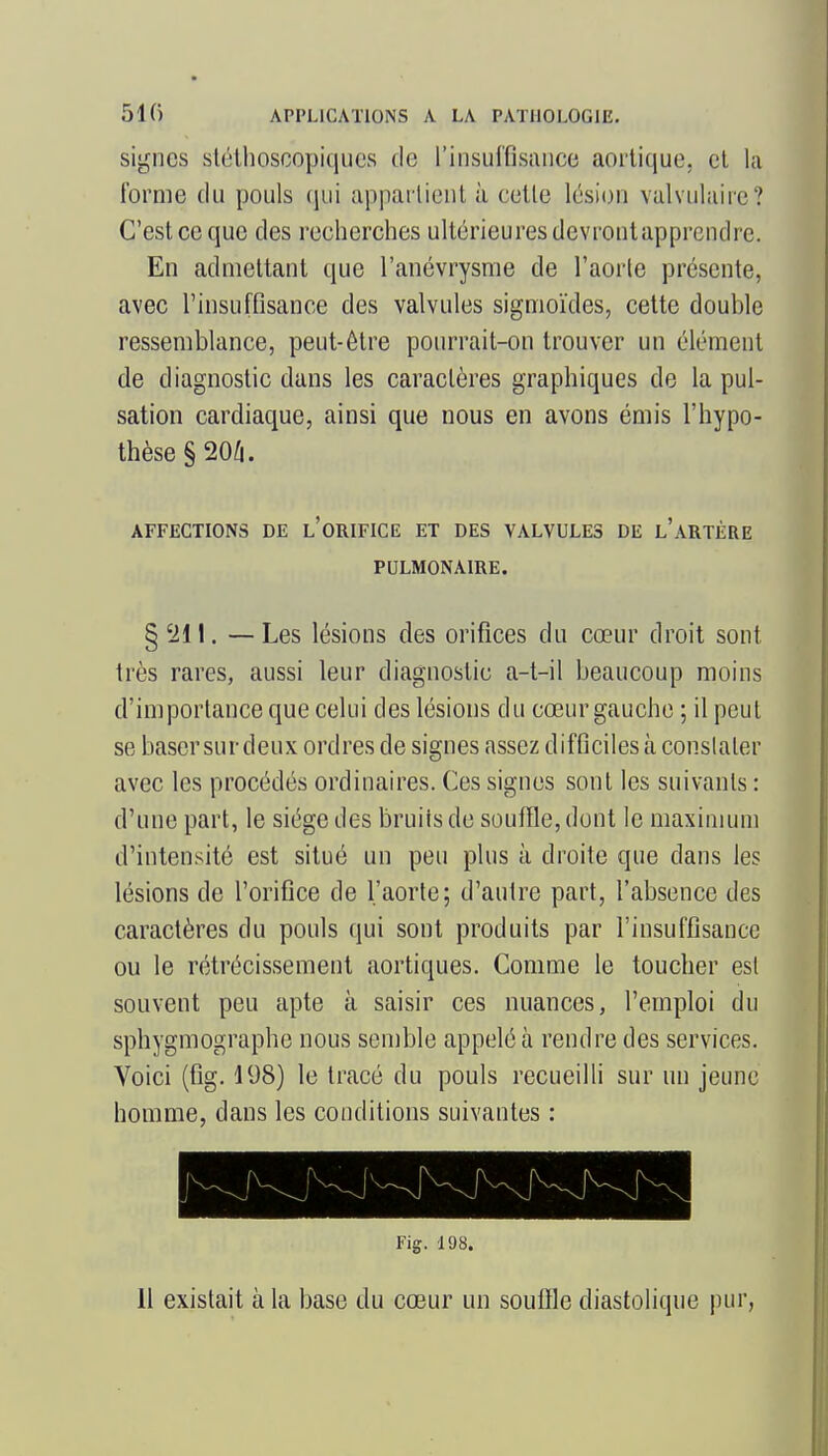 signes slélhoscopiqucs de rinsiiffisance aorlique. et la l'orme du pouls qui apparlieul à celle lésion valvulaiic? C'est ce que des recherches ultérieures devronlapprcndre. En admettant que l'anévrysme de l'aorle présente, avec l'insuffisance des valvules sigmoïdes, cette double ressemblance, peut-être pourrait-on trouver un élément de diagnostic dans les caractères graphiques de la pul- sation cardiaque, ainsi que nous en avons émis l'hypo- thèse §20/i. AFFECTIONS DE l'ORIFICE ET DES VALVULES DE l'aRTÈRE PULMONAIRE. § 'il I. — Les lésions des orifices du cœur droit sont très rares, aussi leur diagnostic a-t-il beaucoup moins d'importance que celui des lésions du cœur gauche ; il peut se baser sur deux ordres de signes assez difficiles à constater avec les procédés ordinaires. Ces signes sont les suivants : d'une part, le siège des bruils de souffle, dont le niaxiiiium d'intensité est situé un peu plus à droite que dans les lésions de l'orifice de l'aorte; d'autre part, l'absence des caractères du pouls qui sont produits par l'insuffisance ou le rétrécissement aortiques. Comme le toucher est souvent peu apte à saisir ces nuances, l'emploi du sphygmographe nous senible appelé à rendre des services. Voici (flg. 198) le tracé du pouls recueilli sur un jeune homme, dans les conditions suivantes : Fig. 198.