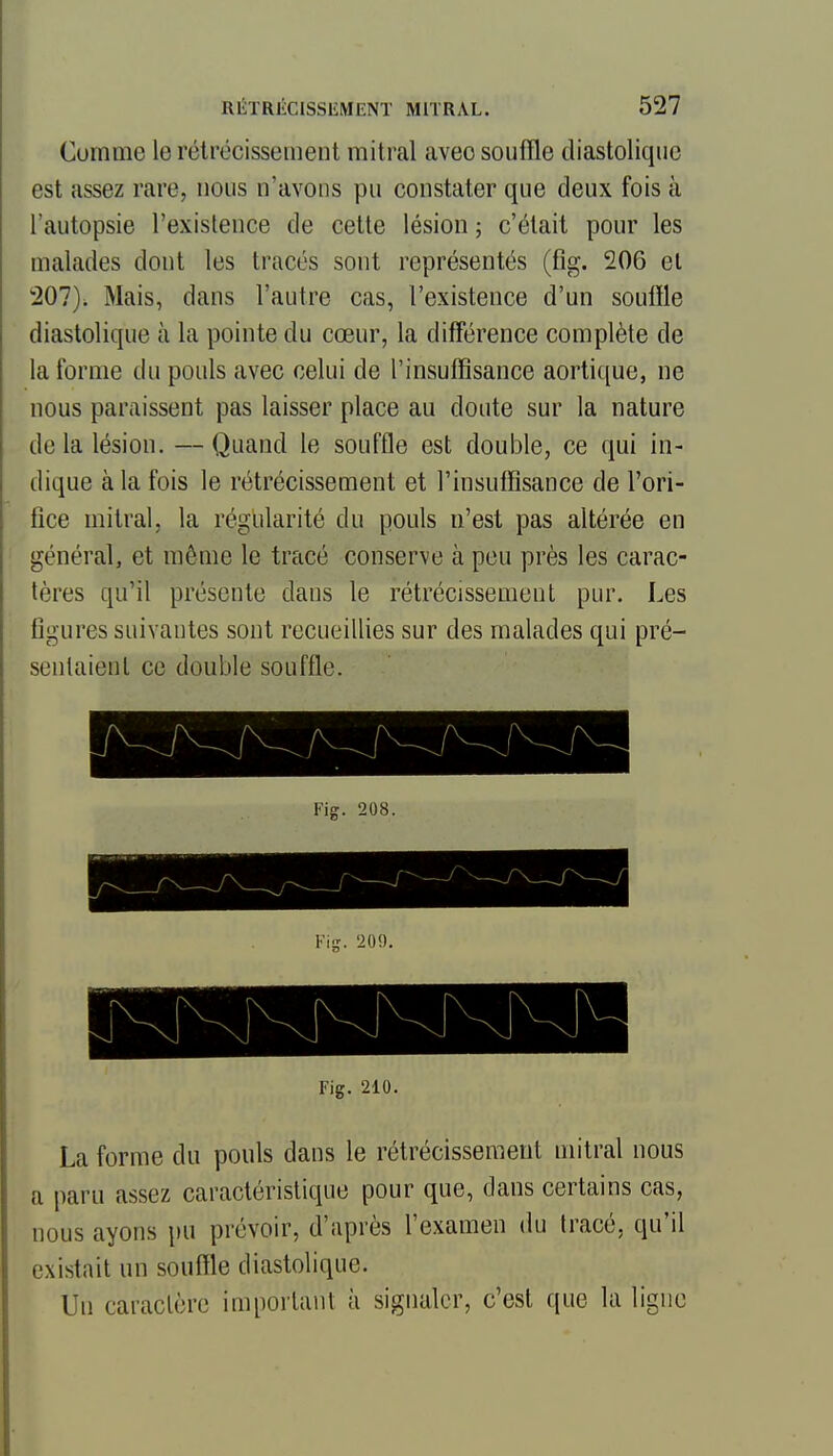 Comme le rétrécissement mitral avec souffle diastolique est assez rare, nous n'avons pu constater que deux fois à l'autopsie l'existence de cette lésion ; c'était pour les malades dont les tracés sont représentés (fig. 206 et 207). Mais, dans l'autre cas, l'existence d'un souffle diastolique à la pointe du cœur, la différence complète de la forme du pouls avec celui de l'insuffisance aortique, ne nous paraissent pas laisser place au doute sur la nature de la lésion. — Quand le souffle est double, ce qui in- dique à la fois le rétrécissement et rinsulfîsance de l'ori- fice mitral, la régularité du pouls n'est pas altérée en général, et même le tracé conserve à peu près les carac- tères qu'il présente dans le rétrécissement pur. Les figures suivantes sont recueillies sur des malades qui pré- sentaient ce double souffle. Fig. 210. La forme du pouls dans le rétrécissement mitral nous a paru assez caractéristique pour que, dans certains cas, nous ayons pu prévoir, d'après l'examen du tracé, qu'il existait un souffle diastolique. Un caractère important à signaler, c'est que la ligne