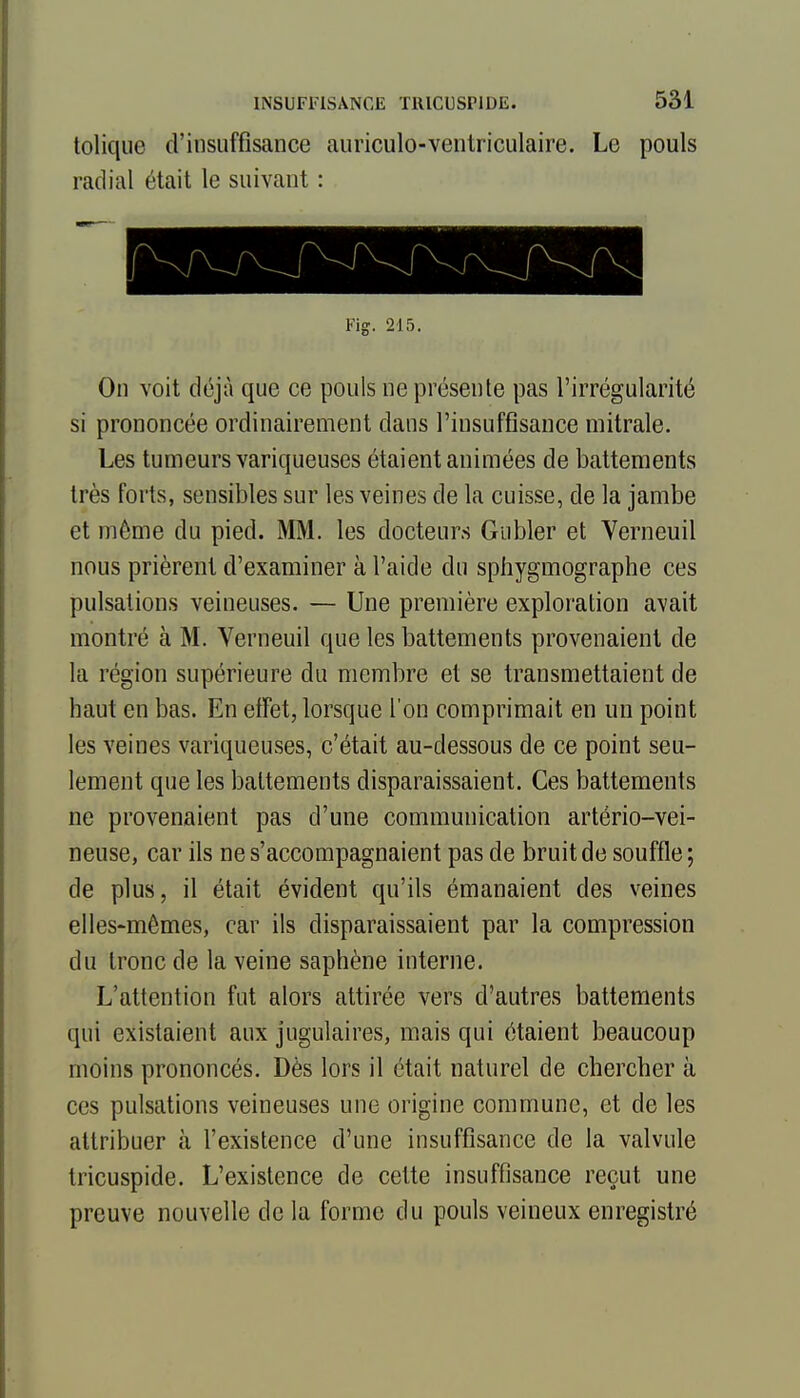 toliqiie d'insuffisance auriculo-ventriculaire. Le pouls radial était le suivant : i'ig. 215. On voit déjà que ce pouls ne présente pas l'irrégularité si prononcée ordinairement dans l'insuffisance niitrale. Les tumeurs variqueuses étaient animées de battements très forts, sensibles sur les veines de la cuisse, de la jambe et même du pied. MM. les docteurs Giibler et Verneuil nous prièrent d'examiner à l'aide du sphygmographe ces pulsations veineuses. — Une première exploration avait montré à M. Verneuil que les battements provenaient de la région supérieure du membre et se transmettaient de haut en bas. En effet, lorsque l'on comprimait en un point les veines variqueuses, c'était au-dessous de ce point seu- lement que les battements disparaissaient. Ces battements ne provenaient pas d'une communication artério-vei- neuse, car ils ne s'accompagnaient pas de bruit de souffle ; de plus, il était évident qu'ils émanaient des veines elles-mêmes, car ils disparaissaient par la compression du tronc de la veine saphène interne. L'attention fut alors attirée vers d'autres battements qui existaient aux jugulaires, mais qui étaient beaucoup moins prononcés. Dès lors il était naturel de chercher à ces pulsations veineuses une origine commune, et de les attribuer à l'existence d'une insuffisance de la valvule tricuspide. L'existence de cette insuffisance reçut une preuve nouvelle de la forme du pouls veineux enregistré