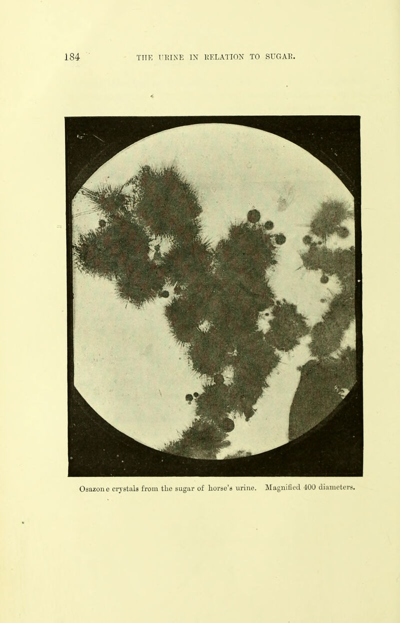 Osazone crystals iVoin the sugar of liorso's uriiio. ilagnilicd -100 diaimHers.