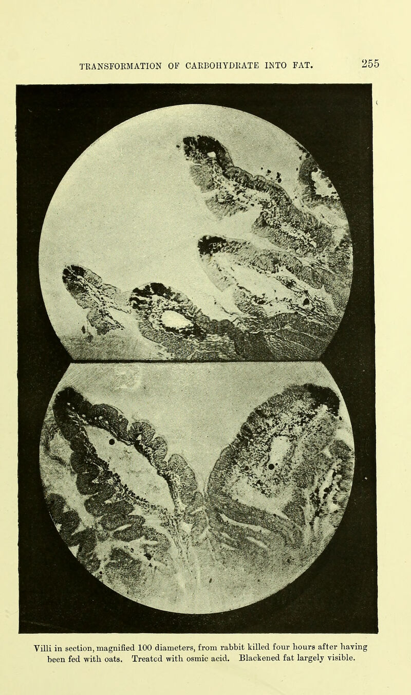 Villi in section, magnified 100 diameters, from rabbit killed four hours after having been fed with oats. Treated with osmic acid. Blackened fat largely visible.