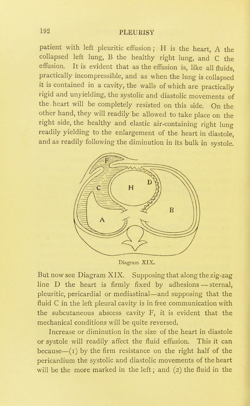 patient with left pleuritic effusion; H is the heart, A the collapsed left lung, B the healthy right lung, and C the effusion. It is evident that as the effusion is, like all fluids, practically incompressible, and as when the lung is collapsed it is contained in a cavity, the walls of which are practically rigid and unyielding, the systolic and diastolic movements of the heart will be completely resisted on this side. On the other hand, they will readily be allowed to take place on the right side, the healthy and elastic air-containing right lung readily yielding to the enlargement of the heart in diastole, and as readily following the diminution in its bulk in systole. Diagram XIX. But now see Diagram XIX. Supposing that along the zig-zag line D the heart is firmly fixed by adhesions — sternal, pleuritic, pericardial or mediastinal—and supposing that the fluid C in the left pleural cavity is in free communication with the subcutaneous abscess cavity F, it is evident that the mechanical conditions will be quite reversed. Increase or diminution in the size of the heart in diastole or systole will readily affect the fluid effusion. This it can because—(i) by the firm resistance on the right half of the pericardium the systolic and diastolic movements of the heart will be the more marked in the left; and (2) the fluid in the