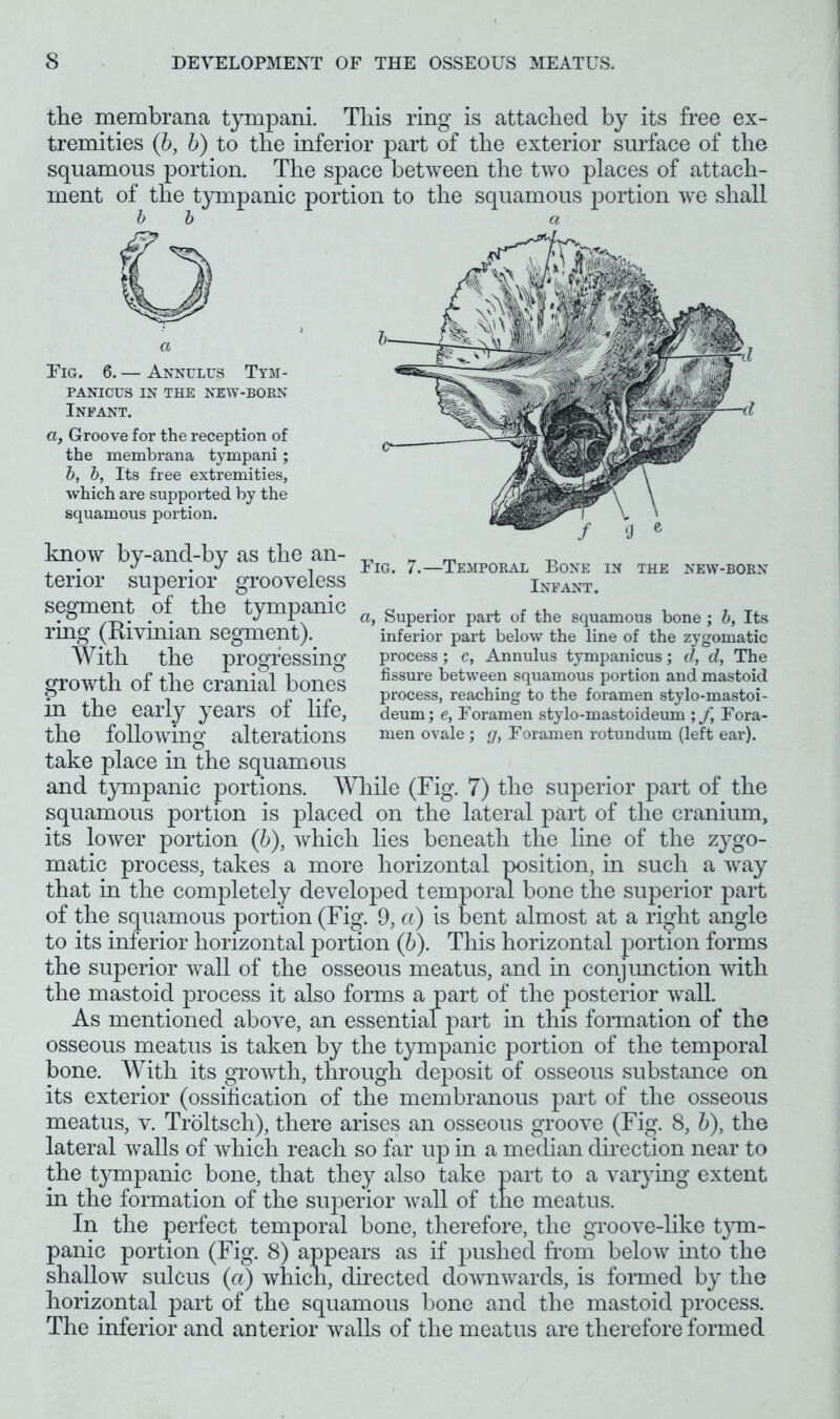 the membrana tympani. This ring is attached by its free ex- tremities (b, b) to the inferior part of the exterior surface of the squamous portion. The space between the two places of attach- ment of the tympanic portion to the squamous portion we shall b b a PANICUS IN THE NEW-BORN Infant. a, Groove for the reception of the membrana tympani; b, b, Its free extremities, which are supported by the squamous portion. Fig. 7.—Temporal Bone in the new-born Infant. a, Superior part of the squamous bone; b, Its inferior part below the line of the zygomatic process; c, Annulus tympanicus; d, d, The fissure between squamous portion and mastoid process, reaching to the foramen stylo-mastoi- deum; e, Foramen stylo-mastoideum ; /, Fora- men ovale ; g, Foramen rotundum (left ear). know by-and-by as the an- terior superior grooveless segment of the tympanic ring (Kivinian segment). With the progressing growth of the cranial bones in the early years of life, the following alterations take place in the squamous and tympanic portions. While (Fig. 7) the superior part of the squamous portion is placed on the lateral part of the cranium, its lower portion (6), which lies beneath the line of the zygo- matic process, takes a more horizontal position, in such a way that in the completely developed temporal bone the superior part of the squamous portion (Fig. 9, a) is bent almost at a right angle to its inferior horizontal portion (b). This horizontal portion forms the superior wall of the osseous meatus, and in conjunction with the mastoid process it also forms a part of the posterior wall. As mentioned above, an essential part in this formation of the osseous meatus is taken by the tympanic portion of the temporal bone. With its growth, through deposit of osseous substance on its exterior (ossification of the membranous part of the osseous meatus, v. Troltsch), there arises an osseous groove (Fig. 8, b), the lateral walls of which reach so far up in a median direction near to the tympanic bone, that they also take part to a varying extent in the formation of the superior wall of the meatus. In the perfect temporal bone, therefore, the groove-like tym- panic portion (Fig. 8) appears as if pushed from below into the shallow sulcus (a) which, directed downwards, is formed by the horizontal part of the squamous bone and the mastoid process. The inferior and anterior walls of the meatus are therefore formed