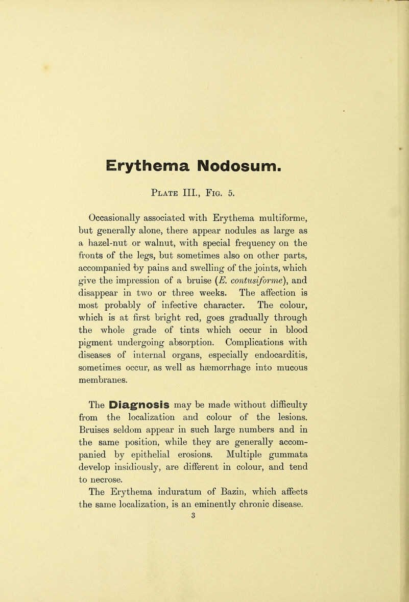 Erythema Nodosum Plate III., Fig. 5. Occasionally associated with Erythema multiforme, but generally alone, there appear nodules as large as a hazel-nut or walnut, with special frequency on the fronts of the legs, but sometimes also on other parts, accompanied by pains and swelling of the joints, which give the impression of a bruise {E. contusiforme), and disappear in two or three weeks. The affection is most probably of infective character. The colour, which is at first bright red, goes gradually through the whole grade of tints which occur in blood pigment undergoing absorption. Complications with diseases of internal organs, especially endocarditis, sometimes occur, as well as haemorrhage into mucous membranes. The Dia.gfnoSiS may be made without difficulty from the localization and colour of the lesions. Bruises seldom appear in such large numbers and in the same position, while they are generally accom- panied by epithelial erosions. Multiple gummata develop insidiously, are different in colour, and tend to necrose. The Erythema induratum of Bazin, which affects the same localization, is an eminently chronic disease.