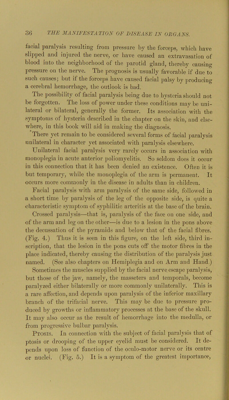 facial paralysis resulting from pressure by the forceps, which have slipped and injured the nerve, or have caused an extravasation of blood into the neighborhood of the parotid gland, thereby causing pressure on the nerve. The prognosis is usually favorable if due to such causes; but if the forceps have caused facial palsy by producing a cerebral hemorrhage, the outlook is bad. The possibility of facial paralysis being due to hysteria should not be forgotten. The loss of power under these conditions may be uni- lateral or bilateral, generally the former. Its association with the .symptoms of hysteria described in the chapter on the skin, and else- where, in this book will aid in makina; the diagnosis. There yet remain to be considered several forms of facial paralysis unilateral in character yet associated with paralysis elsewhere. Unilateral facial ])aralysis very rarely occurs in association with monoplegia in acute anterior ]>oliomyelitis. So seldom does it occur in this connection that it has been denied an existence. Often it is but temporary, while the monoplegia of the arm is permanent. It occurs more commonly in the di.sease in adults thau in children. l^'acial paralysis with arm paralysis of the same side, followed in a short time by ])aralysis of the leg of the opposite side, is quite a characteristic symj)t(jin of syphilitic arteritis at the base of the brain. Crossed paralysis—that is, paralysis of the face on one side, and of the arm and leg on the other—is due to a lesion in the pons above the decus.sation of the pyramids and below that of the facial fibres. (Fig. 4.) Thus it is seen in this figure, on the left side, third in- scription, that the lesion in the pons cuts off the motor fibres in the place indicated, thereby causing the distribution of the paralysis just named. (See also chapters on Hemiplegia and on Arm and Hand.) Sometimes the muscles supplied by the facial nerve, escape paralysis, but those of the jaw, namely, the masseters and temporals, become paralyzed either bilaterally or more commonly unilaterally. This is a rare affection, and depends upon paralysis of the inferior maxillary branch of the trifacial nerve. This may be due to pressure pro- duced by growths or inflammatory processes at the base of the skull. It may also occur as the result of hemorrhage into the medulla, or from progressive bulbar paralysis. Ptosls. In connection with the subject of facial paralysis that of ptosis or drooping of the upper eyelid must be considered. It de- pends upon loss of function of the oculo-motor nerve or its centre or nuclei. (Fig. 5.) It is a symptom of the greatest importance.