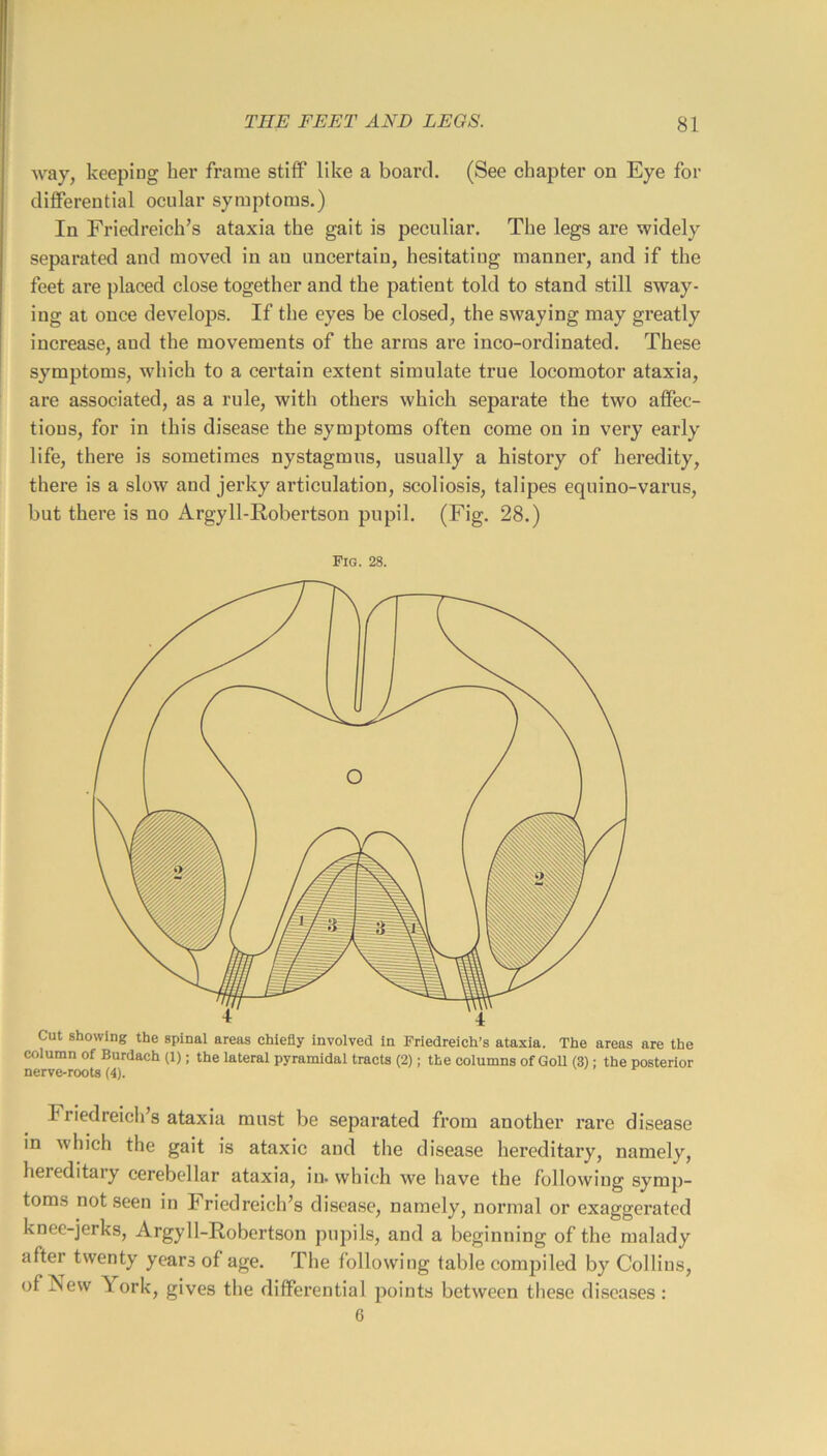 way, keeping her frame stiff like a board. (See chapter on Eye for differential ocular symptoms.) In Friedreich’s ataxia the gait is peculiar. The legs are widely separated and moved in an uncertain, hesitating manner, and if the feet are placed close together and the patient told to stand still sway- ing at once develops. If the eyes be closed, the swaying may greatly increase, and the movements of the arms are inco-ordinated. These symptoms, which to a certain extent simulate true locomotor ataxia, are associated, as a rule, with others which separate the two affec- tions, for in this disease the symptoms often come on in very early life, there is sometimes nystagmus, usually a history of heredity, there is a slow and jerky articulation, scoliosis, talipes equino-varus, but there is no Argyll-Robertson pupil. (Fig. 28.) Fig. 28. Friedreicli’s ataxia must be separated from another rare disease in which the gait is ataxic and the disease hereditary, namely, hereditary cerebellar ataxia, in. which we have the following symp- toms not seen in Friedreich’s disease, namely, normal or exaggerated knee-jerks, Argyll-Robertson pupils, and a beginning of the malady after twenty years of age. The following table compiled by Collins, of New ^ ork, gives the differential points between these di.sca.ses : 6