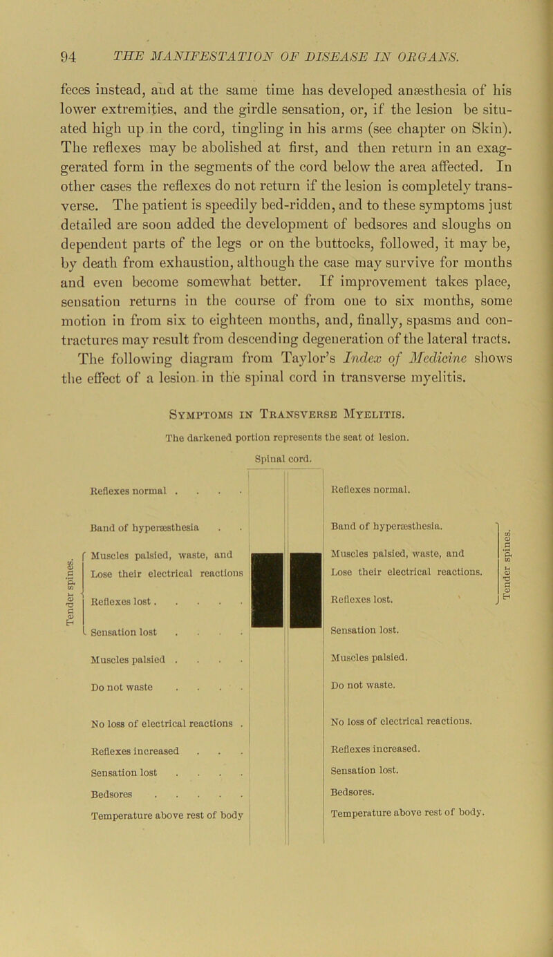 feces instead, and at the same time has developed anaesthesia of his lower extremities, and the girdle sensation, or, if the lesion be situ- ated high up in the cord, tingling in his arms (see chapter on Skin), The reflexes may be abolished at first, and then return in an exag- gerated form in the segments of the cord below the area atfected. In other cases the reflexes do not return if the lesion is completely trans- verse. The patient is speedily bed-ridden, and to these symptoms just detailed are soon added the development of bedsores and sloughs on dependent parts of the legs or on the buttocks, followed, it may be, by death from exhaustion, although the case may survive for months and even become somewhat better. If improvement takes place, sensation returns in the course of from one to six months, some motion in from six to eighteen months, and, finally, spasms and con- tractures may result from descending degeneration of the lateral tracts. The following diagram from Taylor’s Index of Medicine shows the effect of a lesion, in the sj)inal cord in transverse myelitis. Symptoms in Transverse Myelitis. The darkened portion represents the seat of lesion. Spinal cord. Reflexes normal . Reflexes normal. i B ■5. in <u SD B (U Band of hyperajsthesia f Muscles palsied, waste, and Lose their electrical reactions Reflexes lost . Sensation lost .... Muscles palsied .... Band of hypercesthesia. Muscles palsied, waste, and Lose their electrical reactions. Reflexes lost. ' J Sensation lost. Muscles palsied. B 'S Do not waste Do not waste. No loss of electrical reactions . I Reflexes increased Sensation lost .... Bedsores Temperature above rest of body ! No loss of electrical reactions. Reflexes increased. Sensation lost. Bedsores. Temperature above rest of body.