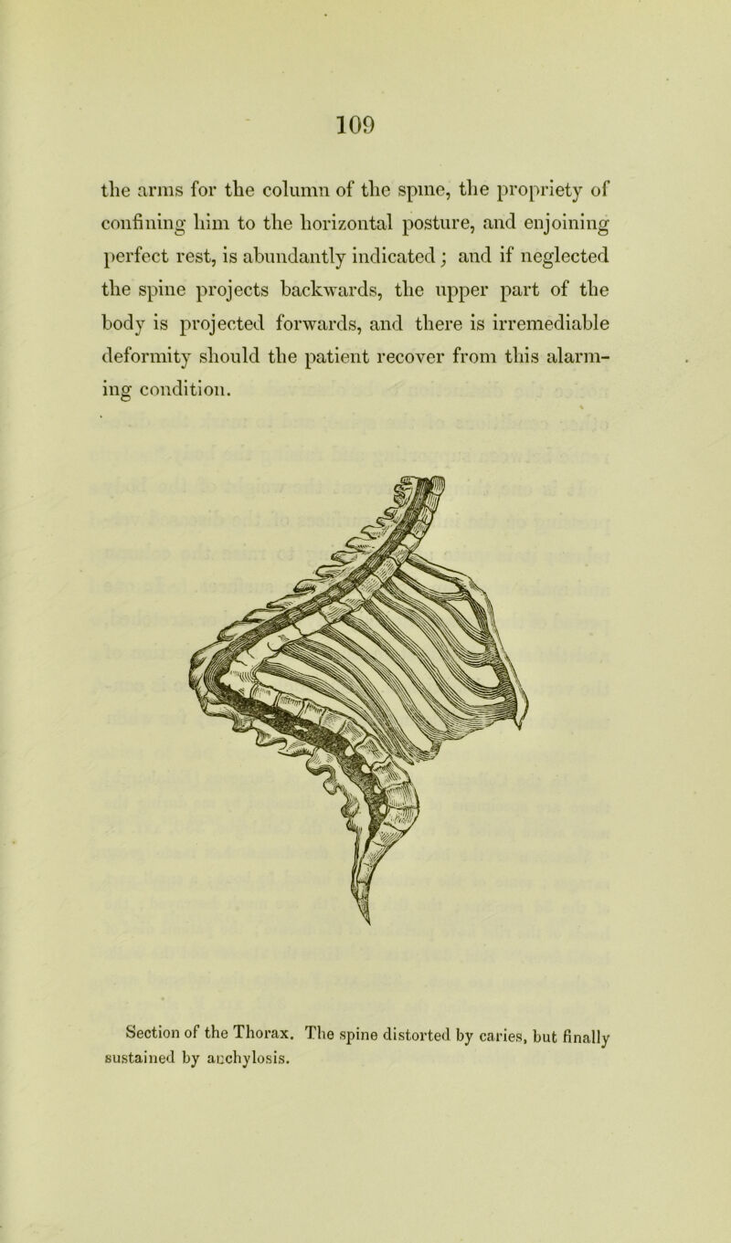 the arms for the column of the spine, the propriety of confining him to the horizontal posture, and enjoining perfect rest, is abundantly indicated; and if neglected the spine projects backwards, the upper part of the body is projected forwards, and there is irremediable deformity should the patient recover from this alarm- ing condition. Section of the Thorax. The spine distorted by caries, but finally sustained by anchylosis.