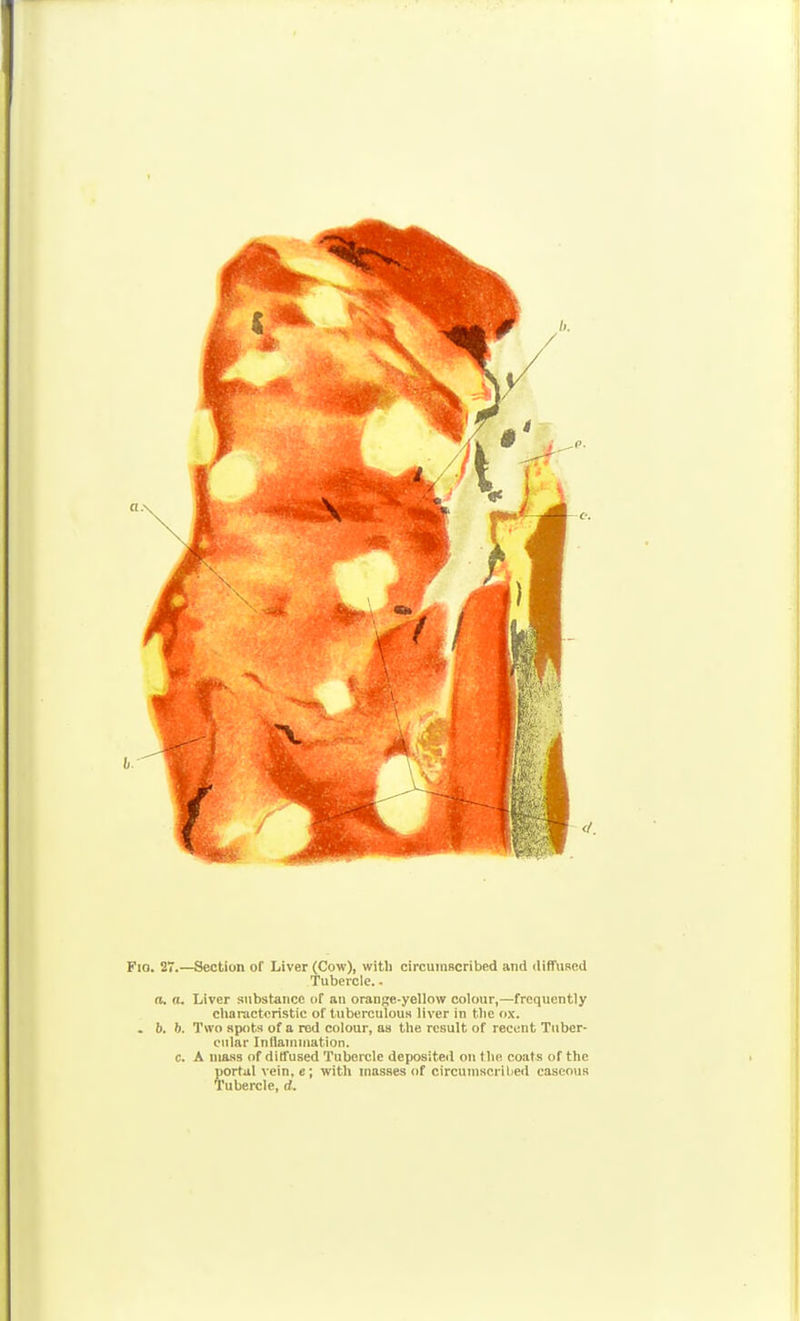 Pio. 27.—Section of Liver (Cow), witli circumBCribed and rtiffuRed Tubercle.. n, a. Liver substance of an orange-yellow colour,—frequently characteristic of tuberculous liver in the ox. . 6. b. Two spots of a rod colour, as the result of recent Tuber- cular Inflaniniation. c. A mass of diffused Tubercle deposited on (lie coats of the portiil vein, e; with masses of circuniscrilie<l caseous Tubercle, d.