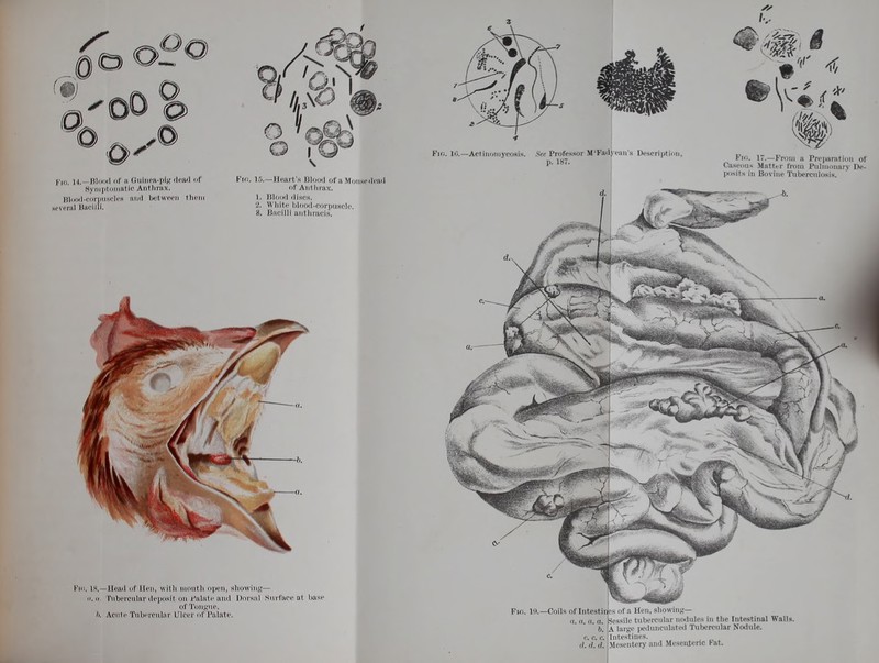 Flo. 14.—Blood (if a Guinea-pig >li'a>l of Pin. IS.—Heart's Blood of a Monscdcad BymptoniatlC Anthrax, of Anthrax. Blood-corpuscles and between them 1. Blood discs, evoral Bacilli. 2- White blood-corpuscle. 8. i;'Hi onthracls, Fin. 19.—Coils oflntestin o. a. a. a. b. ccc ,i. d. <;. Sessile tubercular nodolea In the Intestinal Walls. A large pedunculated Tubercular Nodule. Intestines. Mesentery and Mesenteric Fat.