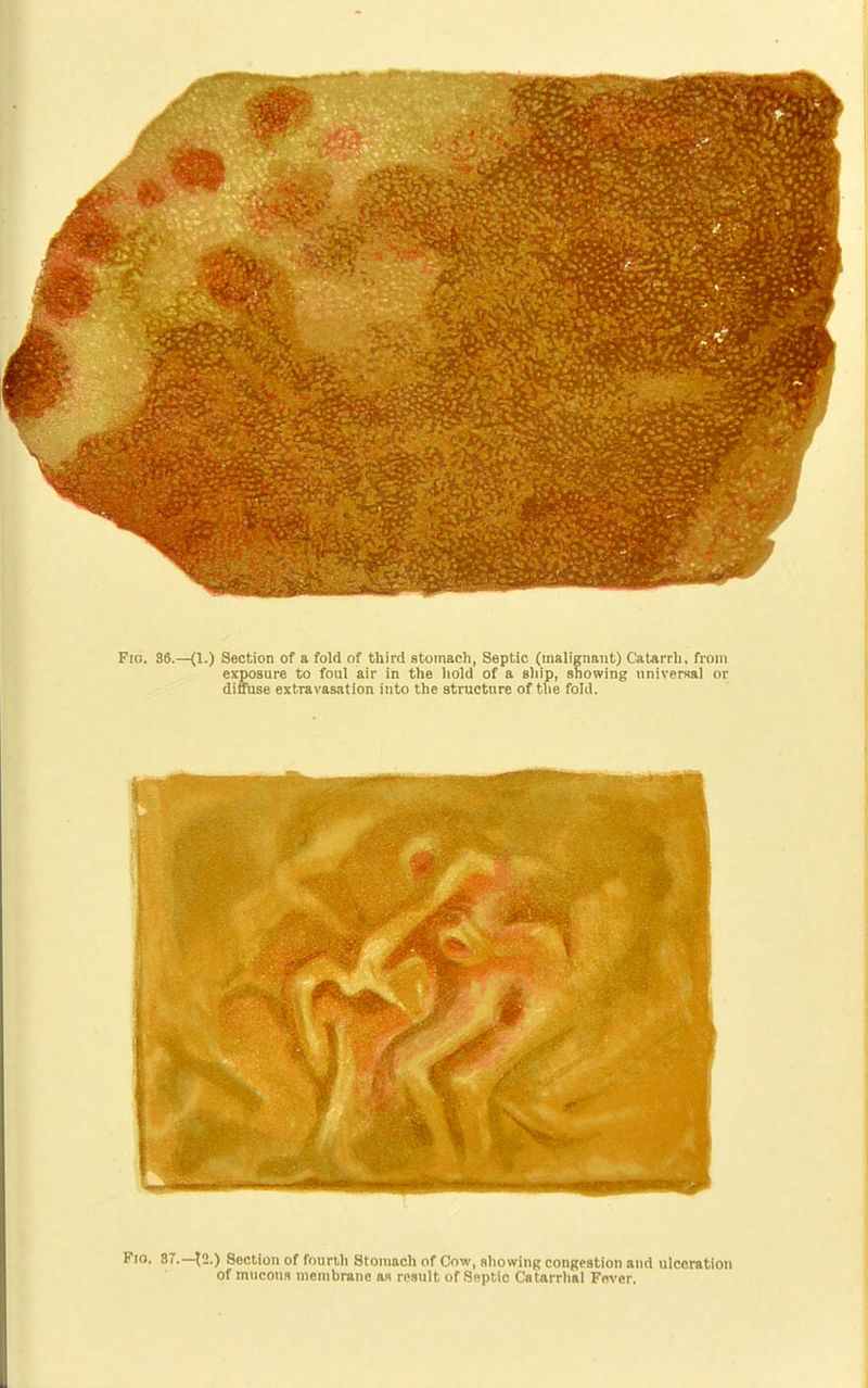 Fio. 36.—(1.) Section of a fold of third stomach, Septic (malignant) Catarrh, from exposure to foul air in the hold of a ship, snowing universal or diffuse extravasation into the structure of the fold. Fio. 37.—t2.) Section of fourth Stomach of Cow, sliowing congestion and ulceration of mucous membrane as result of Septic Catarrhal Fever.