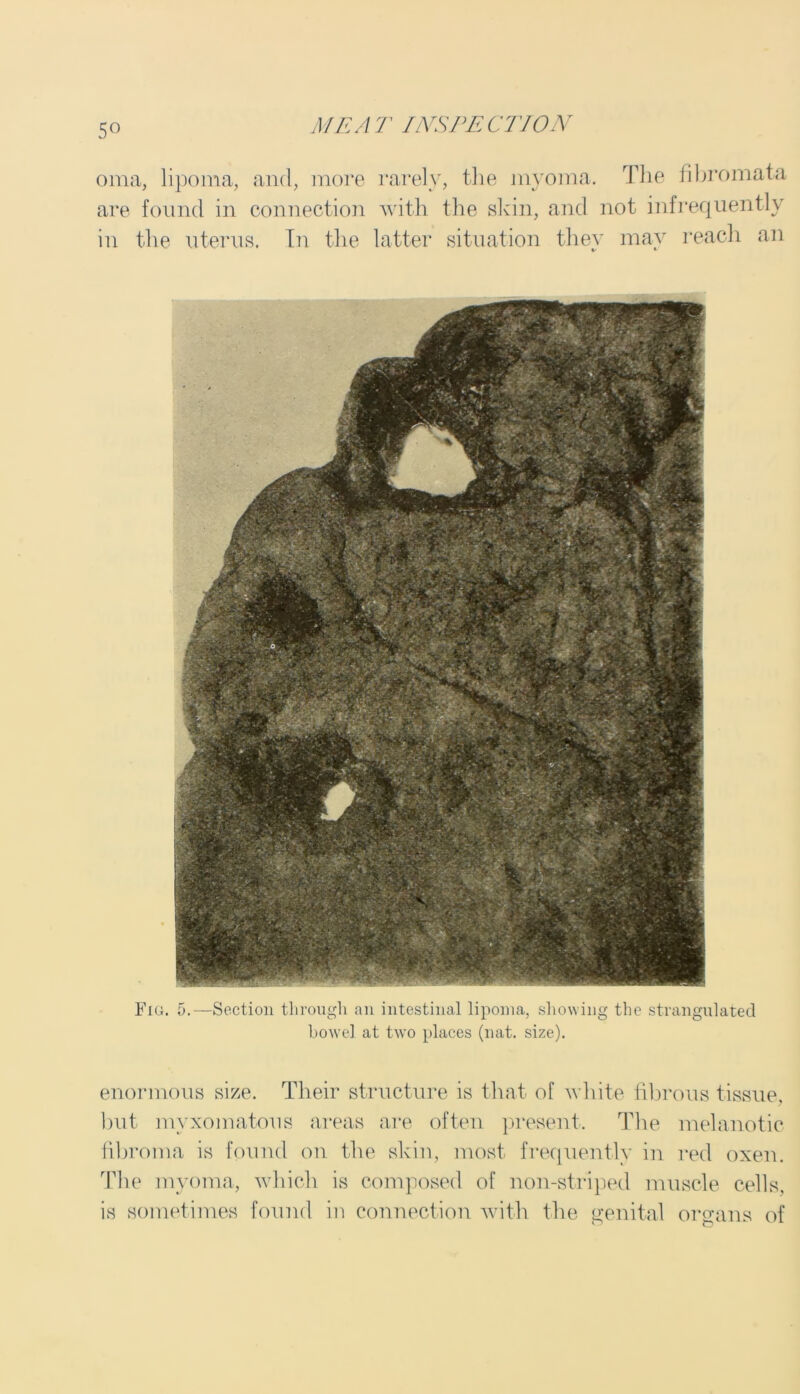 5° oma, lipoma, and, more rarely, the myoma. The fibromata are found in connection with the skin, and not infrequently in the uterus. In the latter situation thev mav reach an %/ *• Fig. 5.—Section through an intestinal lipoma, showing the strangulated bowel at two places (nat. size). enormous size. Their structure is that of white fibrous tissue, but myxomatous areas are often present. The melanotic fibroma is found on the skin, most frequently in red oxen. The myoma, which is composed of non-striped muscle cells, is sometimes found in connection with the genital organs of