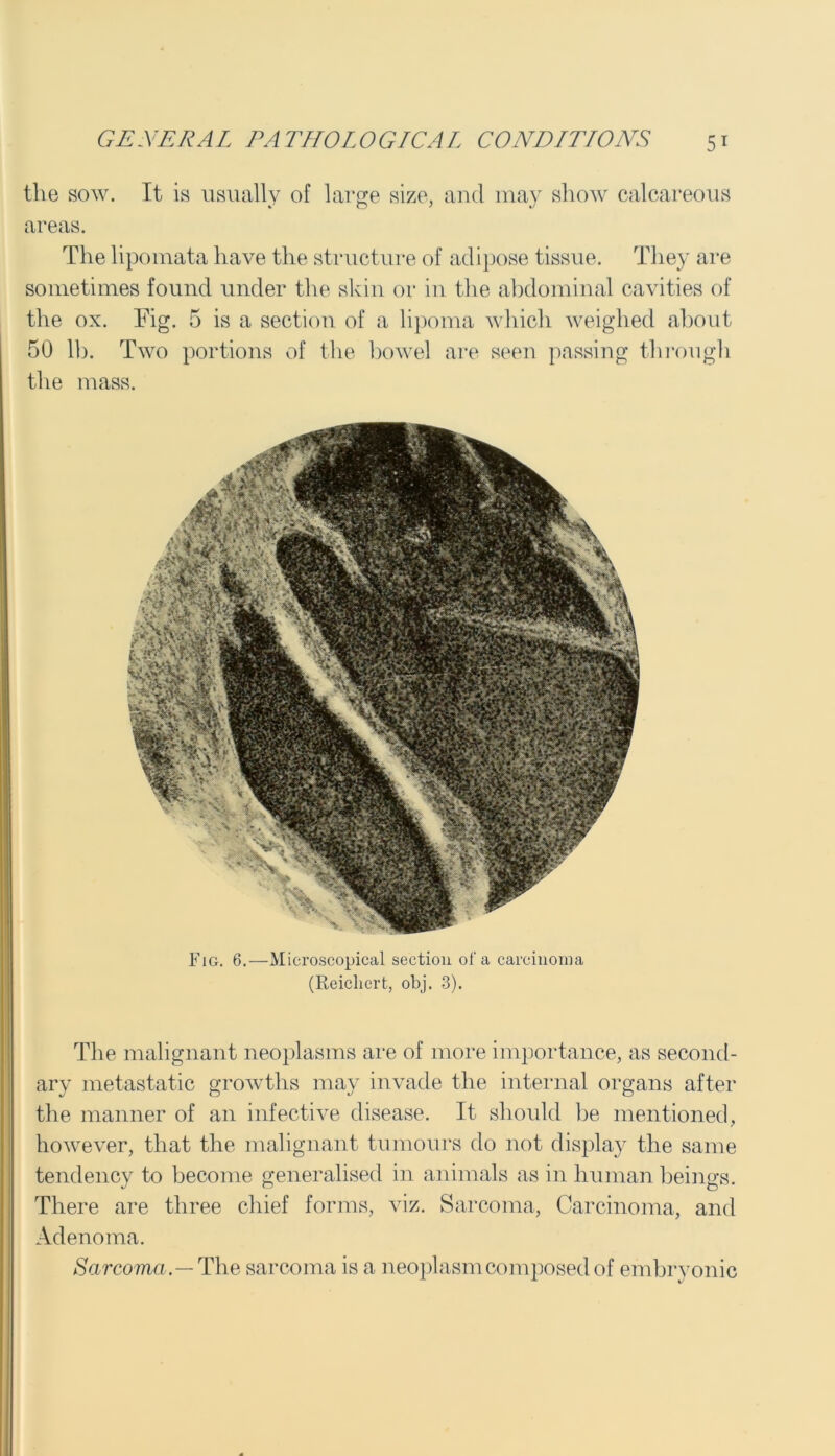 the sow. It is usually of large size, and may show calcareous areas. The lipomata have the structure of adipose tissue. They are sometimes found under the skin or in the abdominal cavities of the ox. Fig. 5 is a section of a lipoma which weighed about 50 lb. Two portions of the bowel are seen passing through the mass. Fig. 6.—Microscopical section of a carcinoma (Reichert, obj. 3). The malignant neoplasms are of more importance, as second- ary metastatic growths may invade the internal organs after the manner of an infective disease. It should be mentioned, however, that the malignant tumours do not display the same tendency to become generalised in animals as in human beings. jo o There are three chief forms, viz. Sarcoma, Carcinoma, and Adenoma. Sarcoma.— The sarcoma is a neoplasm composed of embryonic