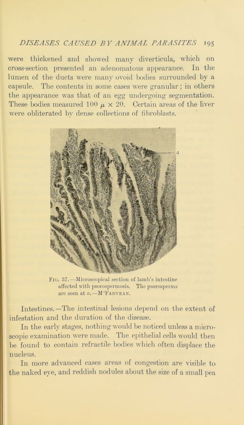 were thickened and showed many diverticula, which on cross-section presented an adenomatous appearance. In the lumen of the ducts were many ovoid bodies surrounded by a capsule. The contents in some cases were granular; in others the appearance was that of an egg undergoing segmentation. These bodies measured 100 /i x 20. Certain areas of the liver were obliterated by dense collections of fibroblasts. Fig. 37.—Microscopical section of lamb’s intestine affected with psorospermosis. The psorosperms are seen at a.—M‘Fa dye AN. Intestines.—The intestinal lesions depend on the extent of infestation and the duration of the disease. In the early stages, nothing would be noticed unless a micro- scopic examination were made. The epithelial cells would then be found to contain retractile bodies which often displace the nucleus. In more advanced cases areas of congestion are visible to the naked eye, and reddish nodules about the size of a small pea