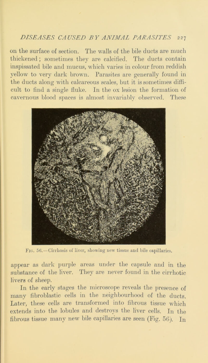 on the surface of section. The walls of the bile ducts are much thickened; sometimes they are calcified. The ducts contain inspissated bile and mucus, which varies in colour from reddish yellow to very dark brown. Parasites are generally found in the ducts along with calcareous scales, but it is sometimes diffi- cult to find a single fluke. In the ox lesion the formation of cavernous blood spaces is almost invariably observed. These Pig. 56.—Cirrhosis of liver, showing new tissue and bile capillaries. appear as dark purple areas under the capsule and in the substance of the liver. They are never found in the cirrhotic livers of sheep. In the early stages the microscope reveals the presence of many fibroblastic cells in the neighbourhood of the ducts. Later, these cells are transformed into fibrous tissue which extends into the lobules and destroys the liver cells. In the fibrous tissue many new bile capillaries are seen (Fig. 56). In