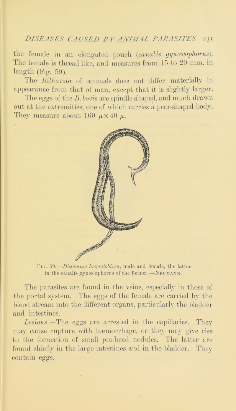 the female 111 ail elongated pouch (canalis gynceco'phorus). The female is thread like, and measures from 15 to 20 mm. in length (Fig. 59). The Bilharzia of animals does not differ materially in appearance from that of man, except that it is slightly larger. The eggs of the 7k bovis are spindle-shaped, and much drawn out at the extremities, one of which carries a pear-shaped body. They measure about 160 ^x40 /x. Fig. 59.—Distomuv 1 haematobium, male and female, the latter in the canalis gynsecopliorus of the former.—Neumann. The parasites are found in the veins, especially in those of the portal system. The eggs of the female are carried by the blood stream into the different organs, particularly the bladder and intestines. Lesions.—The eggs are arrested in the capillaries. They may cause rupture with haemorrhage, or they may give rise to the formation of small pin-head nodules. The latter are found chiefly in the large intestines and in the bladder. They contain eggs.
