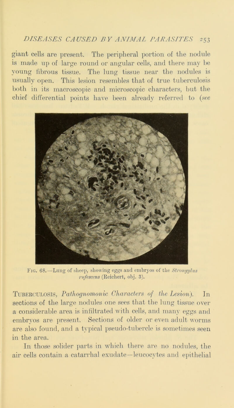 giant cells are present. The peripheral portion of the nodule is made up of large round or angular cells, and there may he young fibrous tissue. The lung tissue near the nodules is usually open. This lesion resembles that of true tuberculosis both in its macroscopic and microscopic characters, but the chief differential points have been already referred to (see Fig. 68.—Lung of sheep, showing eggs and embryos of the Stronyylus rufescens (Reichert, obj. 3). Tuberculosis, Pathognomonic Characters of the Lesion'). In sections of the large nodules one sees that the lung tissue over a considerable area is infiltrated with cells, and many eggs and embryos are present. Sections of older or even adult worms are also found, and a typical pseudo-tubercle is sometimes seen in the area. In those solider parts in which there are no nodules, the air cells contain a catarrhal exudate —leucocytes and epithelial