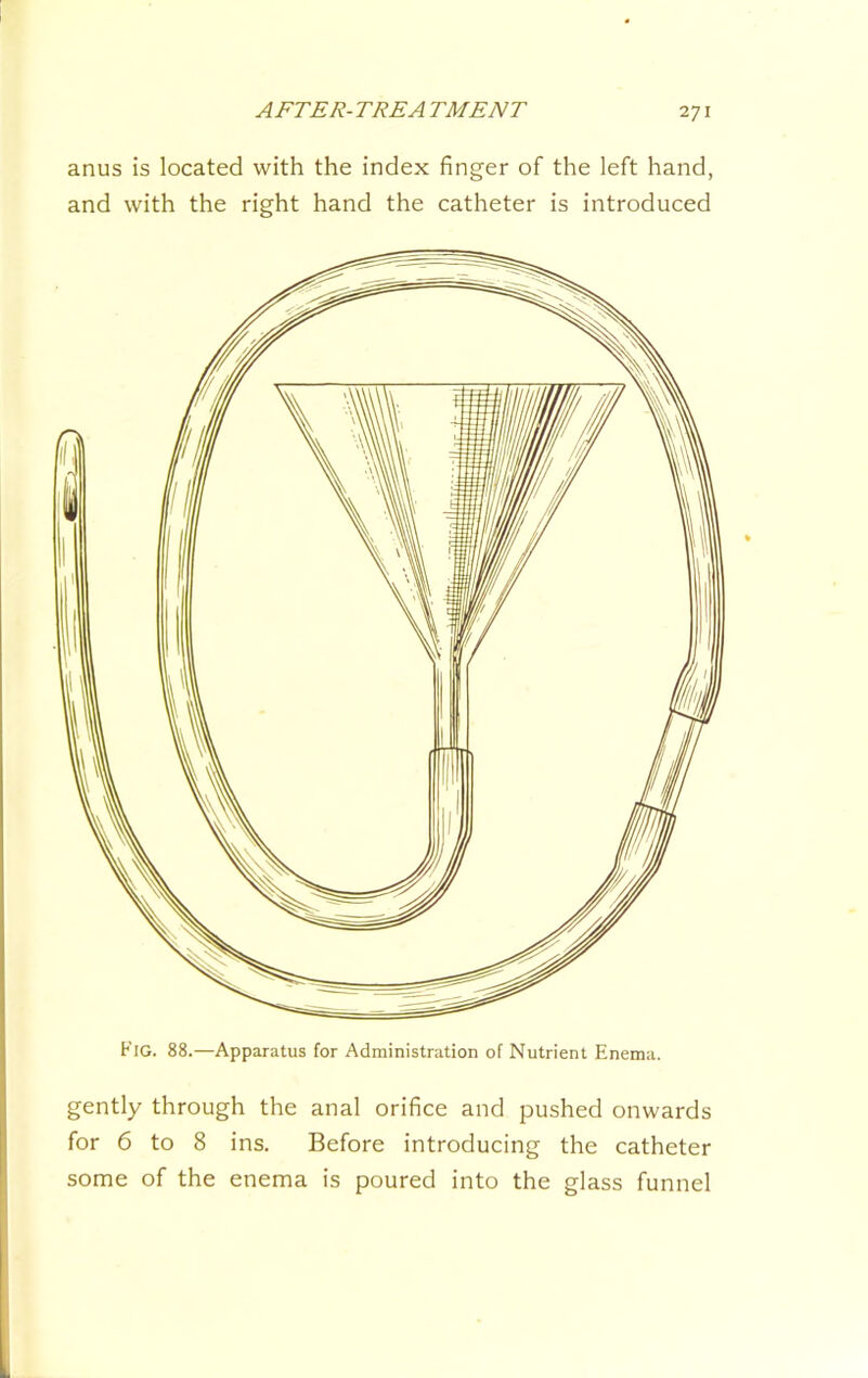 anus is located with the index finger of the left hand, and with the right hand the catheter is introduced Fig. 88.—Apparatus for Administration of Nutrient Enema. gently through the anal orifice and pushed onwards for 6 to 8 ins. Before introducing the catheter some of the enema is poured into the glass funnel