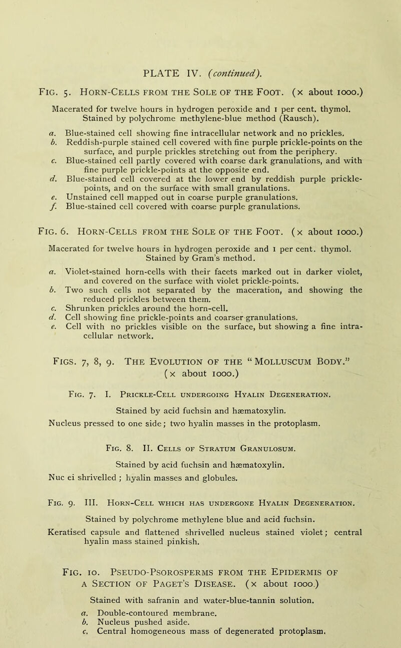 PLATE IV. (continued). Fig. 5. Horn-Cells from the Sole of the Foot, (x about 1000.) Macerated for twelve hours in hydrogen peroxide and I per cent, thymol. Stained by polychrome methylene-blue method (Rausch). a. Blue-stained cell showing fine intracellular network and no prickles, b. Reddish-purple stained cell covered with fine purple prickle-points on the surface, and purple prickles stretching out from the periphery. c. Blue-stained cell partly covered with coarse dark granulations, and with fine purple prickle-points at the opposite end. d. Blue-stained cell covered at the lower end by reddish purple prickle- points, and on the surface with small granulations. e. Unstained cell mapped out in coarse purple granulations. f. Blue-stained cell covered with coarse purple granulations. Fig. 6. Horn-Cells from the Sole of the Foot, (x about 1000.) Macerated for twelve hours in hydrogen peroxide and I per cent, thymol. Stained by Gram’s method. a. Violet-stained horn-cells with their facets marked out in darker violet, and covered on the surface with violet prickle-points. b. Two such cells not separated by the maceration, and showing the reduced prickles between them. c. Shrunken prickles around the horn-cell. d. Cell showing fine prickle-points and coarser granulations. e. Cell with no prickles visible on the surface, but showing a fine intra- cellular network. Figs. 7, 8, 9. The Evolution of the “ Molluscum Body.” (x about 1000.) Fig. 7. I. Prickle-Cell undergoing Hyalin Degeneration. Stained by acid fuchsin and haematoxylin. Nucleus pressed to one side; two hyalin masses in the protoplasm. Fig. 8. II. Cells of Stratum Granulosum. Stained by acid fuchsin and haematoxylin. Nuc ei shrivelled ; hyalin masses and globules. Fig. 9. III. Horn-Cell which has undergone Hyalin Degeneration. Stained by polychrome methylene blue and acid fuchsin. Keratised capsule and flattened shrivelled nucleus stained violet; central hyalin mass stained pinkish. Fig. 10. Pseudo-Psorosperms from the Epidermis of a Section of Paget’s Disease, (x about 1000.) Stained with safranin and water-blue-tannin solution. a. Double-contoured membrane. b. Nucleus pushed aside. c. Central homogeneous mass of degenerated protoplasm.
