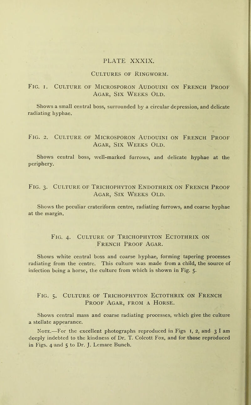 Cultures of Ringworm. Fig. i. Culture of Microsporon Audouini on French Proof Agar, Six Weeks Old. Shows a small central boss, surrounded by a circular depression, and delicate radiating hyphae. Fig. 2. Culture of Microsporon Audouini on French Proof Agar, Six Weeks Old. Shows central boss, well-marked furrows, and delicate hyphae at the periphery. Fig. 3. Culture of Trichophyton Endothrix on French Proof Agar, Six Weeks Old. Shows the peculiar crateriform centre, radiating furrows, and coarse hyphae at the margin. Fig. 4. Culture of Trichophyton Ectothrix on French Proof Agar. Shows white central boss and coarse hyphae, forming tapering processes radiating from the centre. This culture was made from a child, the source of infection being a horse, the culture from which is shown in Fig. 5. Fig. 5. Culture of Trichophyton Ectothrix on French Proof Agar, from a Horse. Shows central mass and coarse radiating processes, which give the culture a stellate appearance. Note.—For the excellent photographs reproduced in Figs 1, 2, and 3 I am deeply indebted to the kindness of Dr. T. Colcott Fox, and for those reproduced
