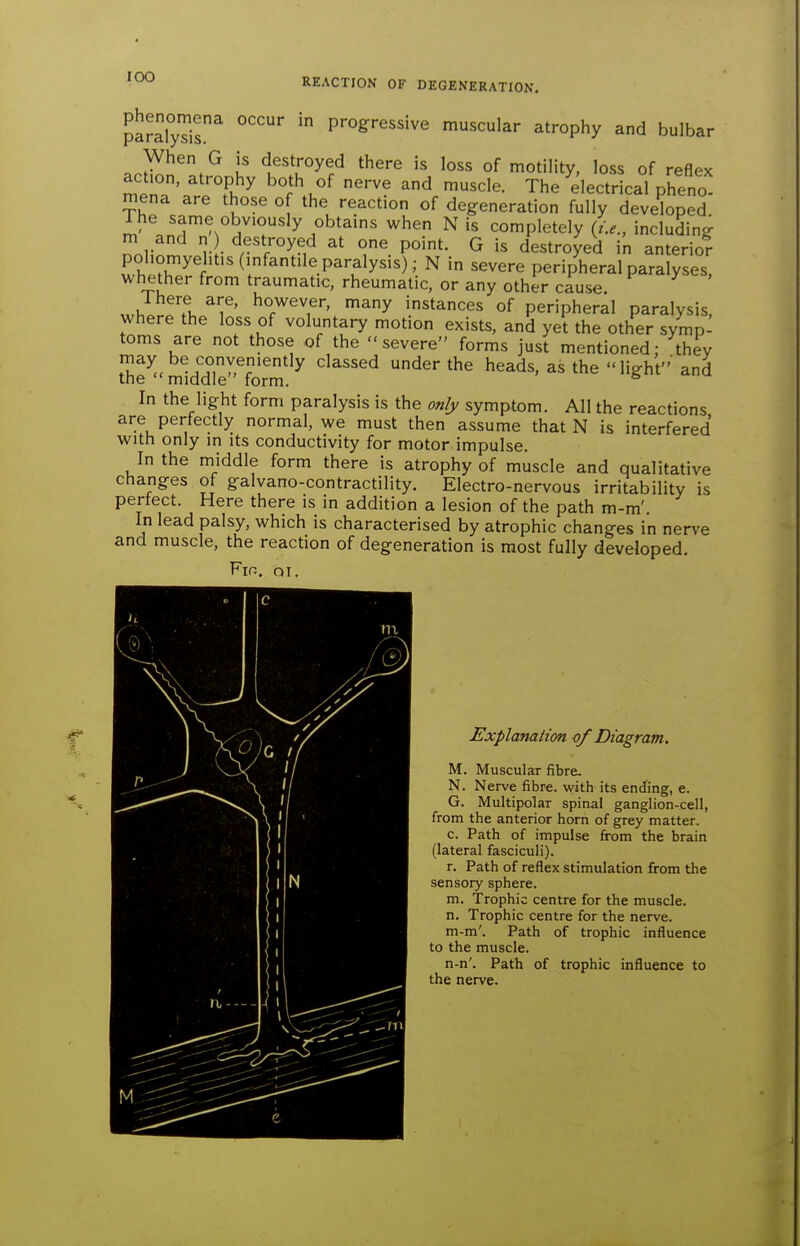lOO paralyTis^ progressive muscular atrophy and bulbar When G is destroyed there is loss of motility, loss of reflex action, atrophy both of nerve and muscle. The electrical phenol mena are those of the reaction of degeneration fully developed The same obviously obtains when N is completely (t.e., including r • P°'t- G is destroyed in anterio? poliomyelitis (infantile paralysis) ; N in severe peripheral paralyses, whether from traumatic, rheumatic, or any other cause. 1 here are, however, many instances of peripheral paralysis where the loss of voluntary motion exists, and yet the other symp- toms are not those of the severe forms just mentioned; they may be conveniently classed under the heads, as the light'and the  middle form. * In the light form paralysis is the on/y symptom. All the reactions are perfectly normal, we must then assume that N is interfered with only in its conductivity for motor impulse. In the middle form there is atrophy of muscle and qualitative changes of galvano-contractility. Electro-nervous irritability is perfect. Here there is in addition a lesion of the path m-m' In lead palsy, which is characterised by atrophic changes in nerve and muscle, the reaction of degeneration is most fully developed. Fir. oi. Explanation of Diagram. M. Muscular fibre. N. Nerve fibre, with its ending, e. G. Multipolar spinal ganglion-cell, from the anterior horn of grey matter. c. Path of impulse from the brain (lateral fasciculi). r. Path of reflex stimulation from the sensory sphere. m. Trophic centre for the muscle. n. Trophic centre for the nerve. m-m'. Path of trophic influence to the muscle. n-n'. Path of trophic influence to the nerve.