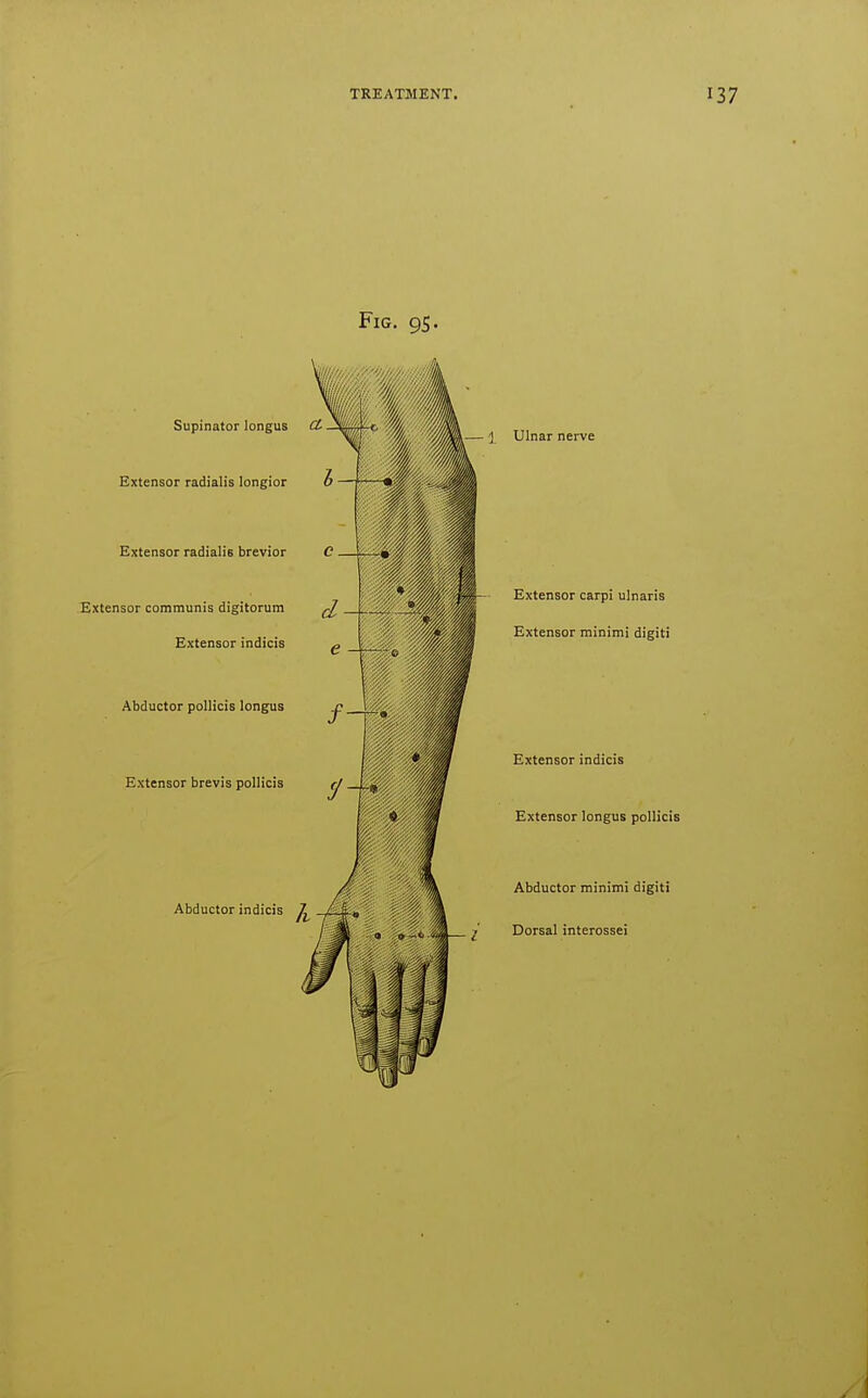 Fig. 95. Supinator longus Ct. Extensor communis digitorum Extensor indicis ji— I Ulnar nerve Extensor radialis longior Extensor radialis brevior C . Extensor carpi ulnaris Extensor minimi digiti Abductor poUicis longus Extensor brevis pollicis Abductor indicis Extensor indicis Extensor longus pollicis Abductor minimi digiti Dorsal interossei