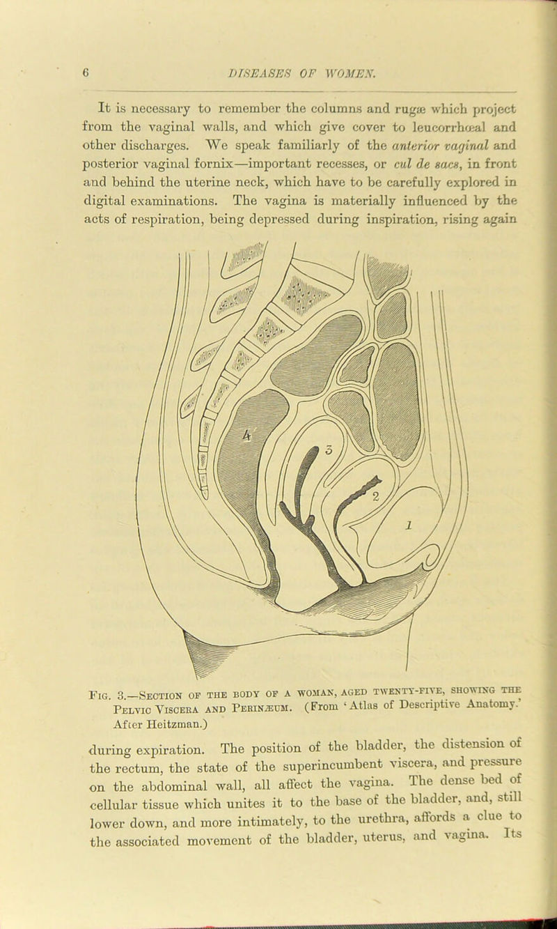 It is necessary to remember the columns and rugse which project from the vaginal walls, and which give cover to leucorrhceal and other discharges. We speak familiarly of the anterior vaginal and posterior vaginal fornix—important recesses, or cul de sacs, in front and behind the uterine neck, which have to be carefully explored in digital examinations. The vagina is materially influenced by the acts of respiration, being depressed during inspiration, rising again Fig. 3.—Section of the body of a woman, aged twenty-five, showing the Pelvic Viscera and Perinzecm. (From ‘Atlas of Descriptive Anatomy. After Heitzman.) during expiration. The position of the bladder, the distension of the rectum, the state of the superincumbent viscera, and pressure on the abdominal wall, all affect the vagina. The dense bed of cellular tissue which unites it to the base of the bladder, and, still lower down, and more intimately, to the urethia, affords a clue to the associated movement of the bladder, uterus, and vagina. Its