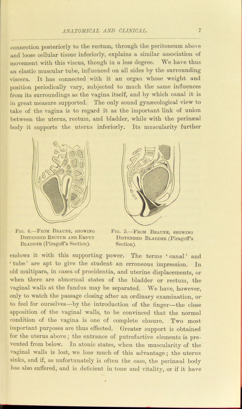 connection posteriorly to the rectum, through the peritoneum above and loose cellular tissue inferiorly, explains a similar association of movement with this viscus, though in a less degree. We have thus an elastic muscular tube, influenced on all sides by the surrounding viscera. It has connected with it an organ whose weight and position periodically vary, subjected to much the same influences from its surroundings as the vagina itself, and by which canal it is in great measure supported. The only sound gynaecological view to take of the vagina is to regard it as the important link of union between the uterus, rectum, and bladder, while with the perinseal body it supports the uterus inferiorly. Its muscularity further Fig. 4.—From Braunb, showing Distended Rectum and Empty Bladdeb (PiragofFs Section). Fig. 5.—From Beaune, showing Distended Bladder (PiragofFs Section). endows it with this supporting power. The terms ‘ canal ’ and ‘ tube ’ are apt to give the student an erroneous impression. In old multipara, in cases of procidentia, and uterine displacements, or when there are abnormal states of the bladder or rectum, the vaginal walls at the fundus may be separated. We have, however, only to watch the passage closing after an ordinary examination, or- to feel for ourselves—by the introduction of the finger—the close apposition of the vaginal walls, to be convinced that the normal condition of the vagina is one of complete closure. Two most important purposes are thus effected. Greater support is obtained for the uterus above; the entrance of putrefactive elements is pre- vented from below. In atonic states, when the muscularity of the vaginal walls is lost, we lose much of this advantage; the uterus sinks, and if, as unfortunately is often the case, the perinseal body has also suffered, and is deficient in tone and vitality, or if it have