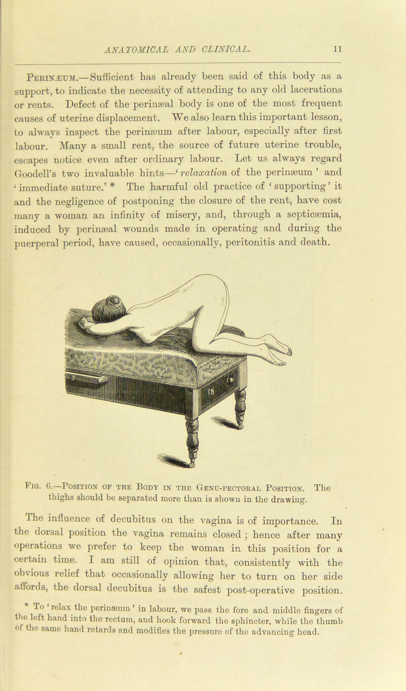 Perin.eom.— Sufficient has already been said of this body as a support, to indicate the necessity of attending to any old lacerations or rents. Defect of the perinatal body is one of the most frequent causes of uterine displacement. We also learn this important lesson, to always inspect the perinaeum after labour, especially after first labour. Many a small rent, the source of future uterine trouble, escapes notice even after ordinary labour. Let us always regard Goodell’s two invaluable hints—' relaxation of the perinasum ’ and ‘ immediate suture.’ * The harmful old practice of ‘ supporting ’ it and the negligence of postponing the closure of the rent, have cost many a woman an infinity of misery, and, through a septicaemia, induced by perinaeal wounds made in operating and during the puerperal period, have caused, occasionally, peritonitis and death. Fig. 6.—Position or the Body in the Genu-pectoral Position. The thighs should be separated more than is shown in the drawing. The influence of decubitus on the vagina is of importance. In the dorsal position the vagina remains closed j hence after many operations we prefer to keep the woman in this position for a certain time. I am still of opinion that, consistently with the obvious relief that occasionally allowing her to turn on her side affords, the dorsal decubitus is the safest post-operative position. To relax the perimeura ’ in labour, we pass the fore and middle fingers of the left hand into the rectum, and hook forward the sphincter, while the thumb of the same hand retards and modifies the pressure of the advancing head.