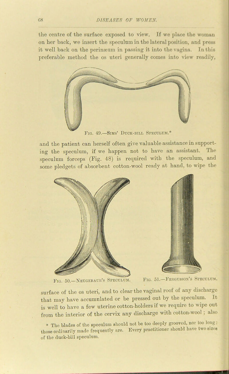 the centre of the surface exposed to view. If we place the woman on her back, we insert the speculum in the lateral position, and press it well back on the perinseum in passing it into the vagina. In this preferable method the os uteri generally comes into view readily, Fig. 49.—Sims’ Duck-bill Speculum.* and the patient can herself often give valuable assistance in support- ing the speculum, if we happen not to have an assistant. The speculum forceps (Fig. 48) is required with the speculum, and some pledgets of absorbent cotton-wool ready at hand, to wipe the surface of the os uteri, and to clear the vaginal roof of any discharge that may have accumulated or be pressed out by the speculum. It is well to have a few uterine cotton-holders if we require to wipe out from the interior of the cervix any discharge with cotton-wool ; also * The blades of the speculum should not be too deeply grooved, nor too long: those ordioarily made frequently are. Every practitioner should have two sizes of the duck-bill speculum.