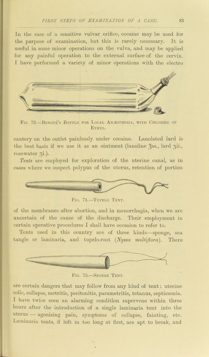 In the case of a sensitive vulvar orifice, cocaine may be used for the purpose of examination, but this is rarely necessary. It is useful in some minor operations on the vulva, and may be applied for any painful operation to the external surface of the cervix. I have performed a variety of minor operations with the electro Fig. 73.—Bengue’s Bottle for Local Anaesthesia, with Chloride of Ethyl. cautery on the outlet painlessly under cocaine. Lanolated lard is the best basis if we use it as an ointment (lanoline Sjss., lard ^ii., rosewater 5L). Tents are employed for exploration of the uterine canal, as in cases -where we suspect polypus of the uterus, retention of portion Fig. 74.—Tupelo Tent. of the membranes after abortion, and in menorrhagia, when we are uncertain of the cause of the discharge. Their employment in certain operative procedures I shall have occasion to refer to. Tents used in this country are of three kinds—sponge, sea tangle or laminaria, and tupelo-root (Nyssa multiflora). There Fig. 75.—Sponge Tent. are certain dangers that may follow from any kind of tent: uterine colic, collapse, metritis, peritonitis, parametritis, tetanus, septicasmia. I have twice seen an alarming condition supervene within three hours after the introduction of a single laminaria tent into the uterus — agonizing pain, symptoms of collapse, fainting, etc. Laminaria tents, if left in too long at first, are apt to break, and