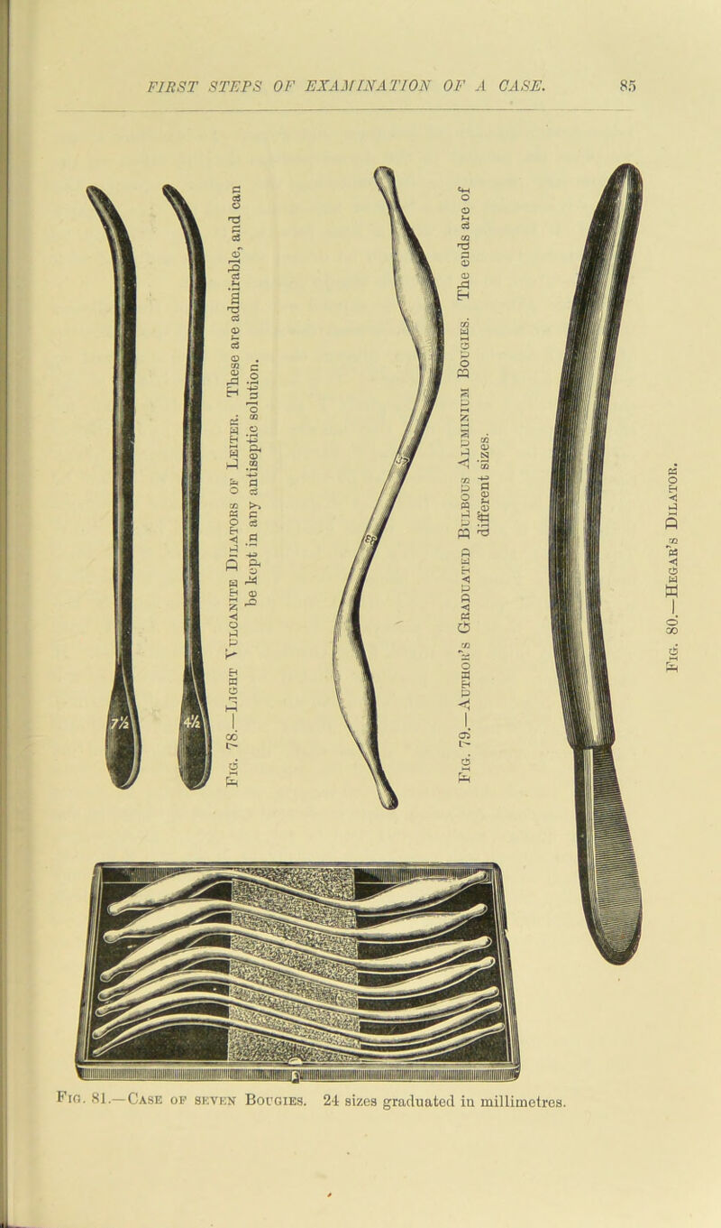 Fig. 81.—Case of seven Bougies. 24 sizes graduated in millimetres. Fig. 80.—Hegak’s Dilator.